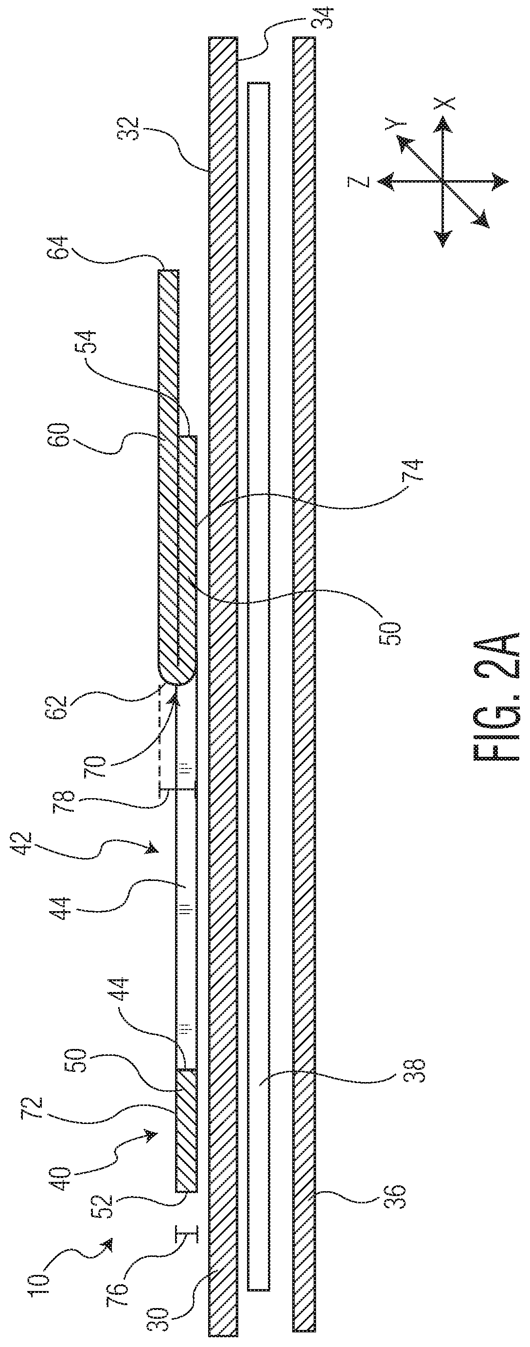 Patent US11771605 Figure 2 – Absorbent article with an exudate management layer