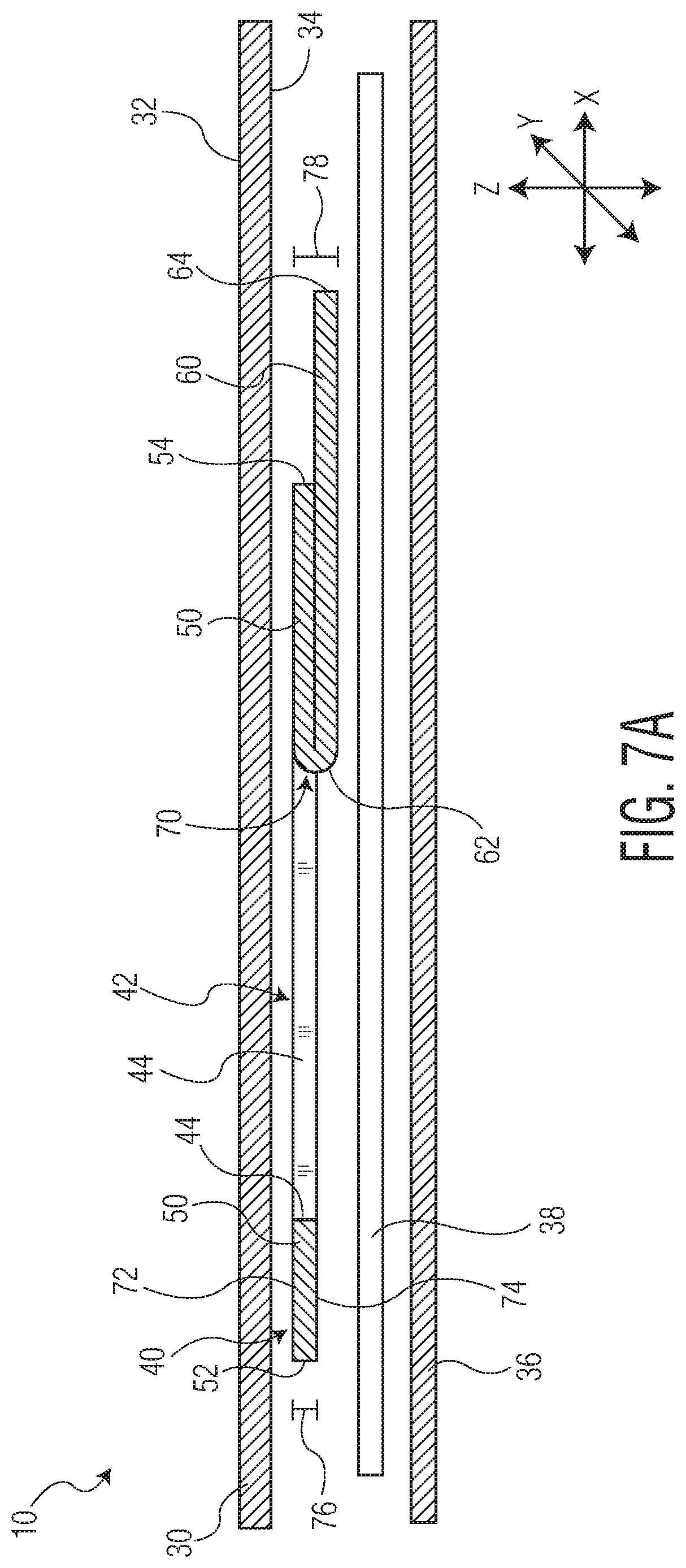 Patent US11771605 Figure 10 – Absorbent article with an exudate management layer