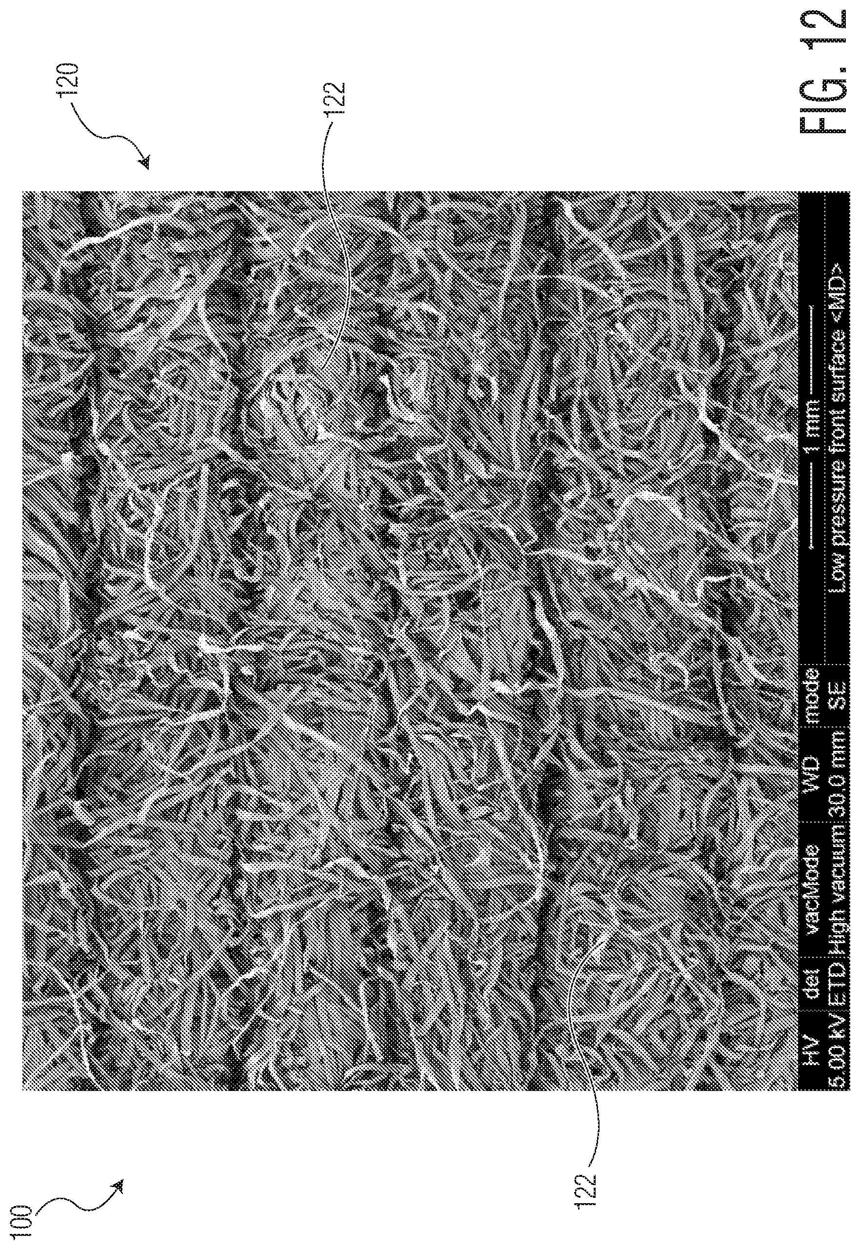 Patent US11771605 Figure 14 – Absorbent article with an exudate management layer