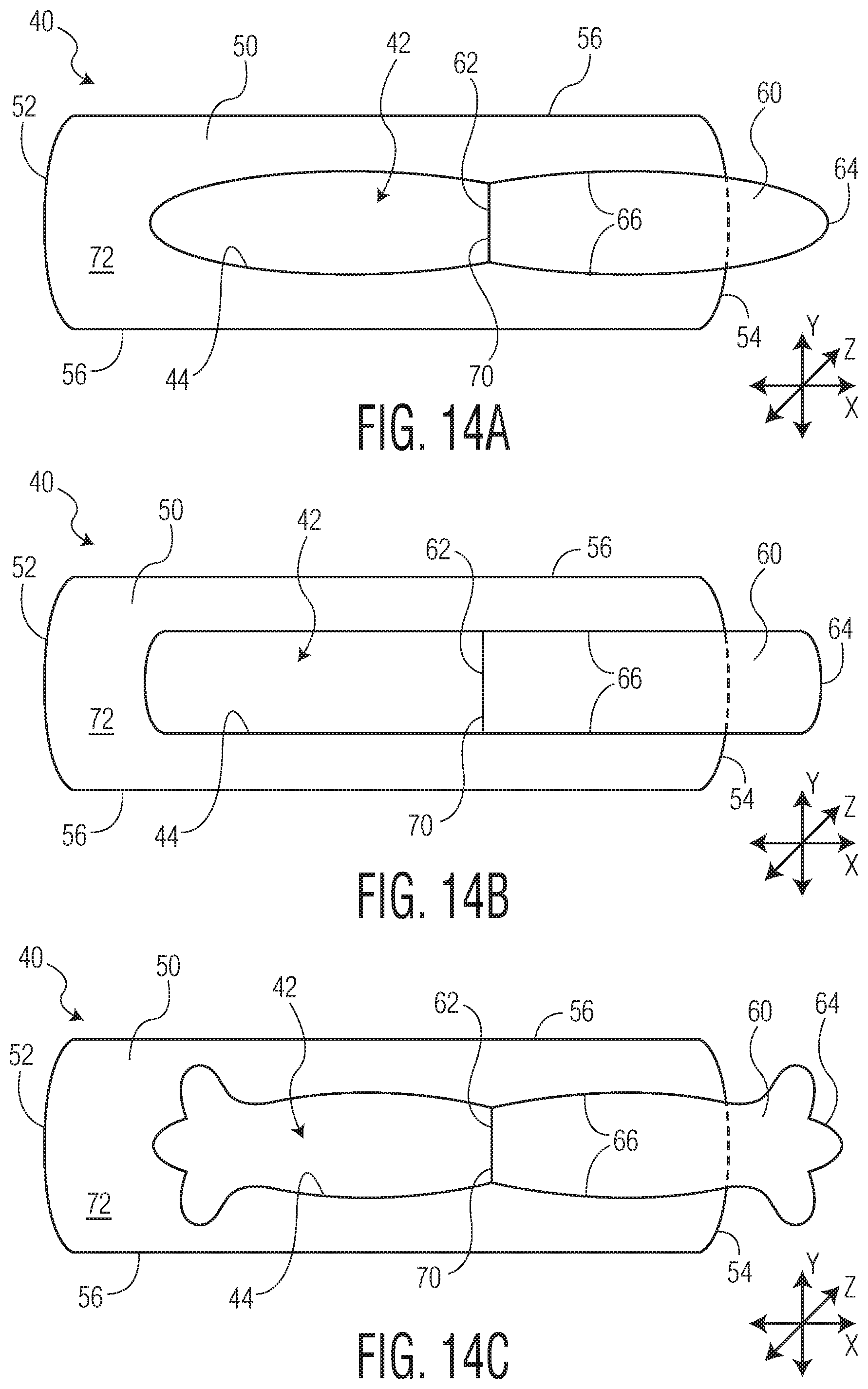 Patent US11771605 Figure 16 – Absorbent article with an exudate management layer