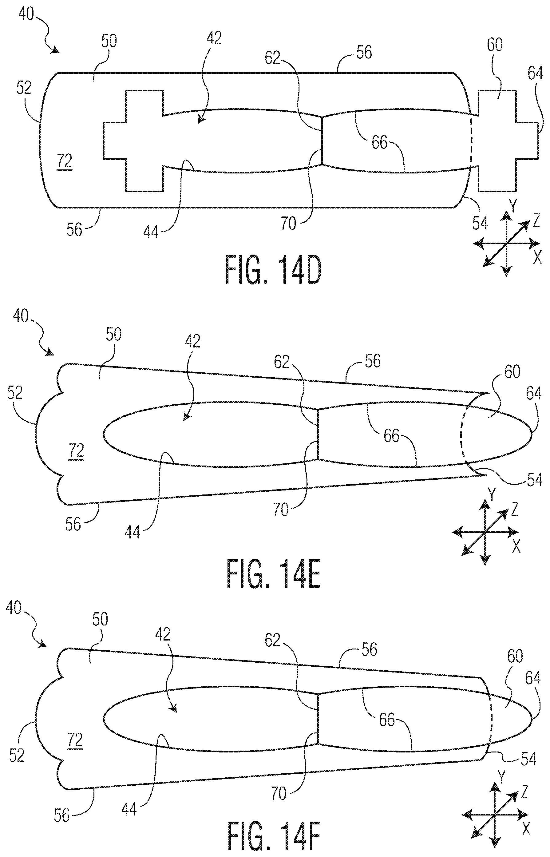 Patent US11771605 Figure 17 – Absorbent article with an exudate management layer
