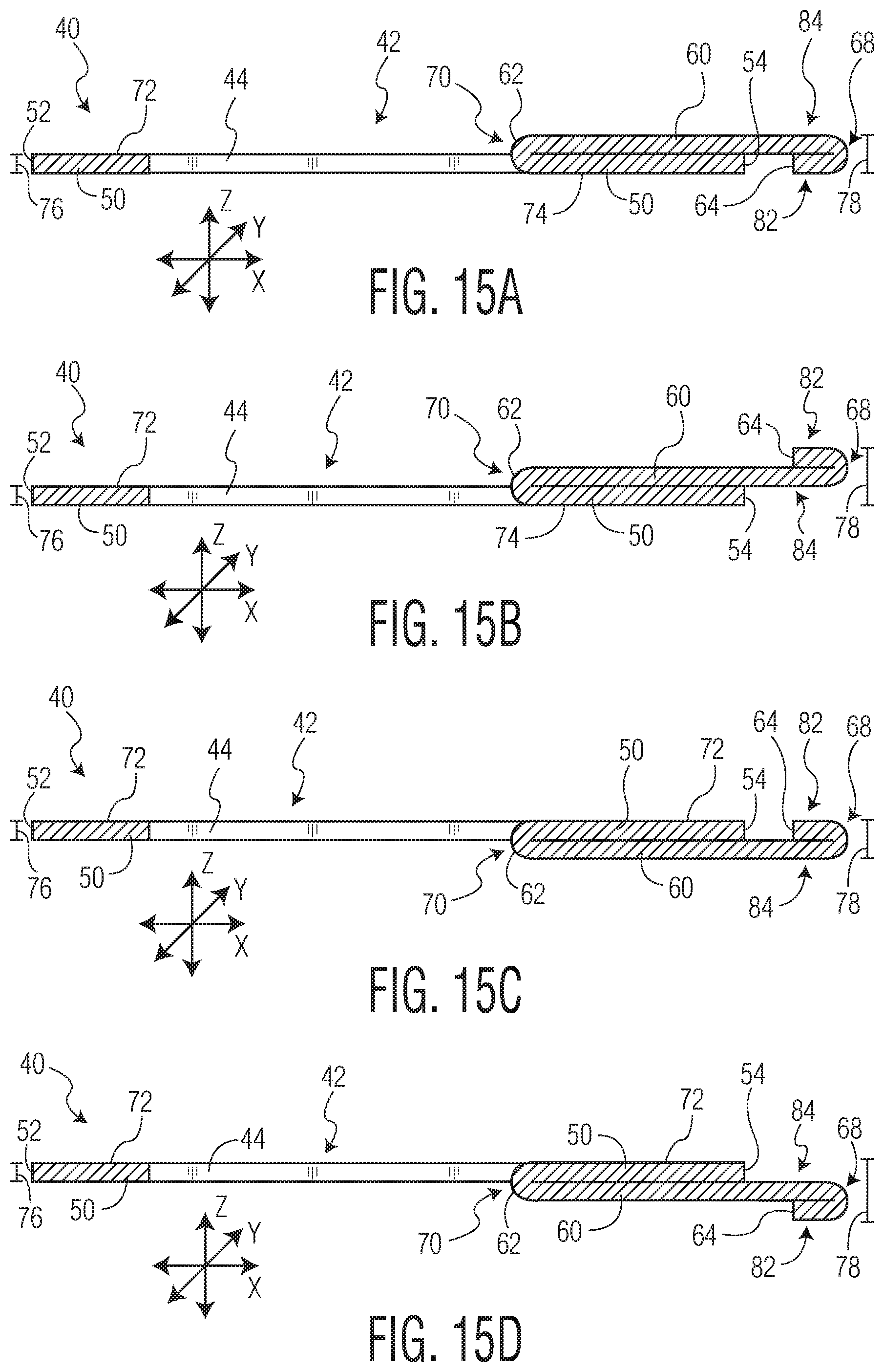 Patent US11771605 Figure 18 – Absorbent article with an exudate management layer