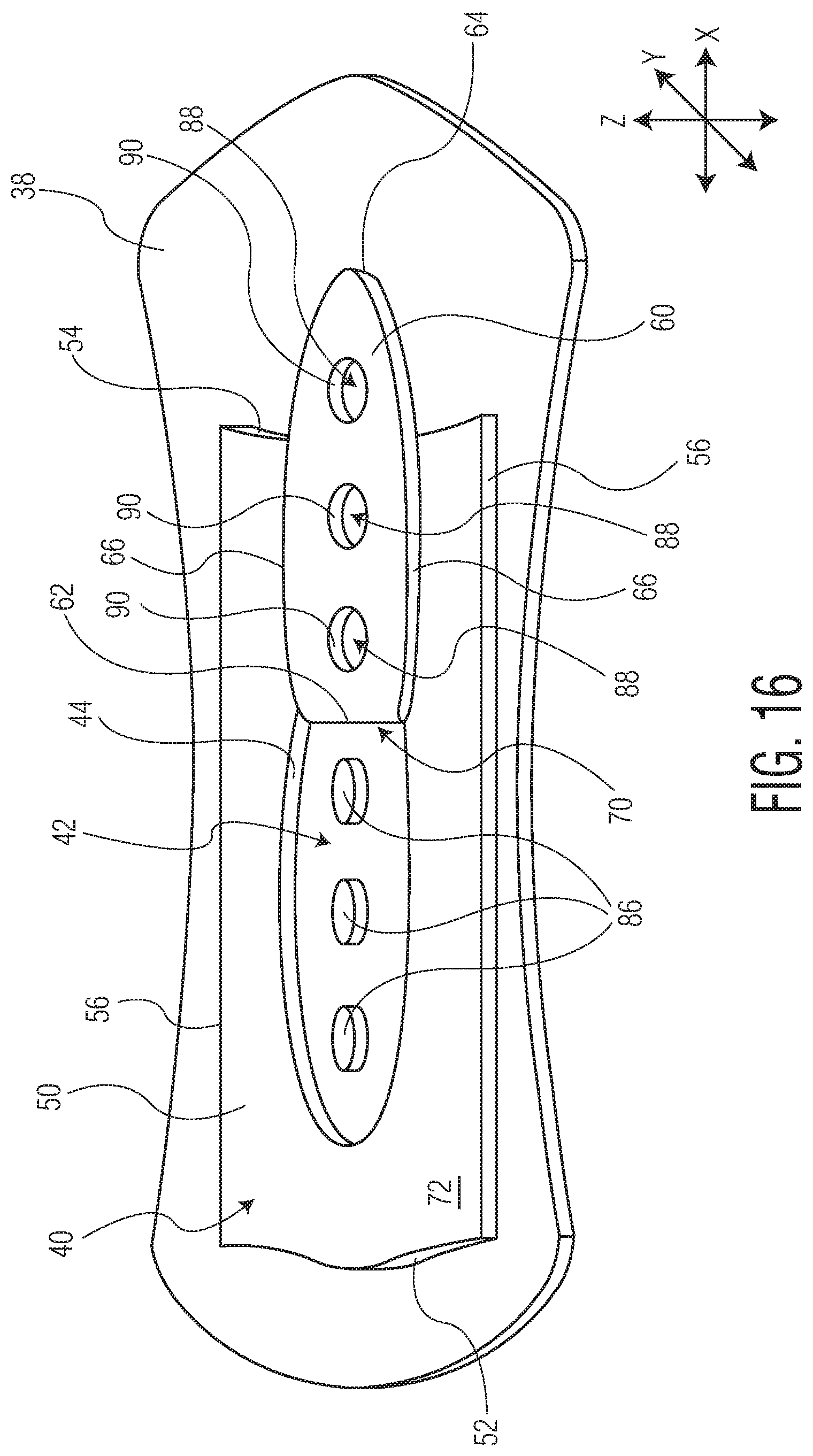 Patent US11771605 Figure 19 – Absorbent article with an exudate management layer