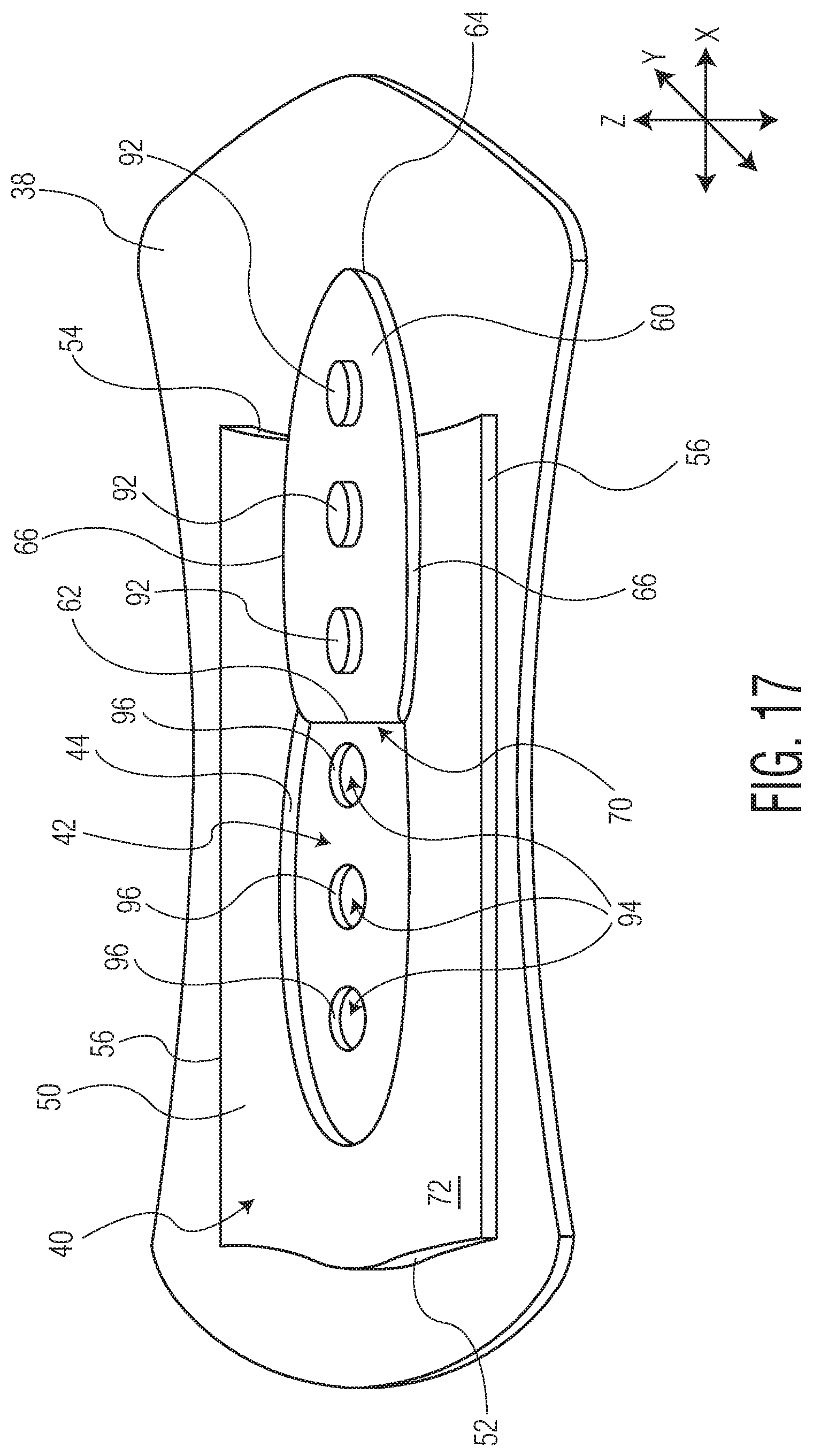 Patent US11771605 Figure 20 – Absorbent article with an exudate management layer