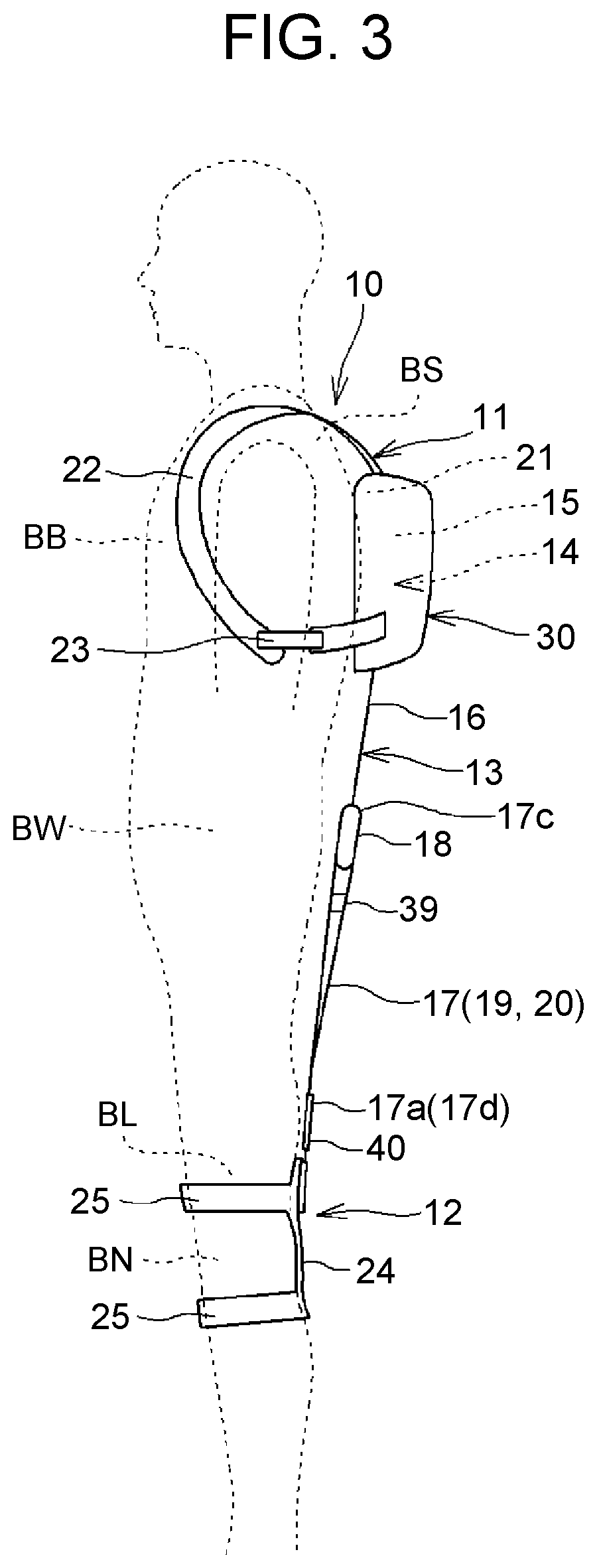 Patent US11771612 Figure 3 – Assist device