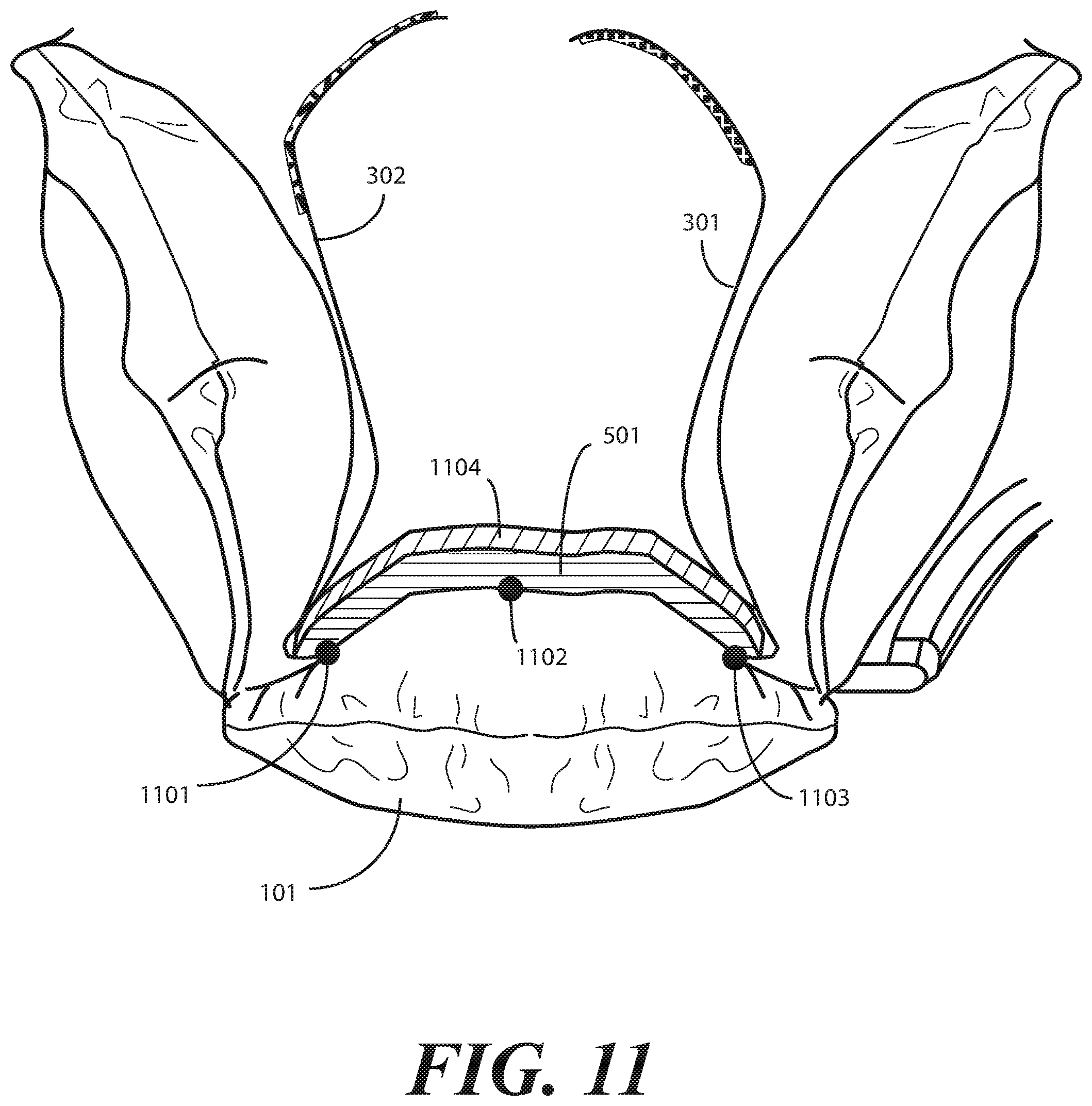 Patent US11771616 Figure 8 – Heel protector and corresponding rehabilitation systems and methods for using the same