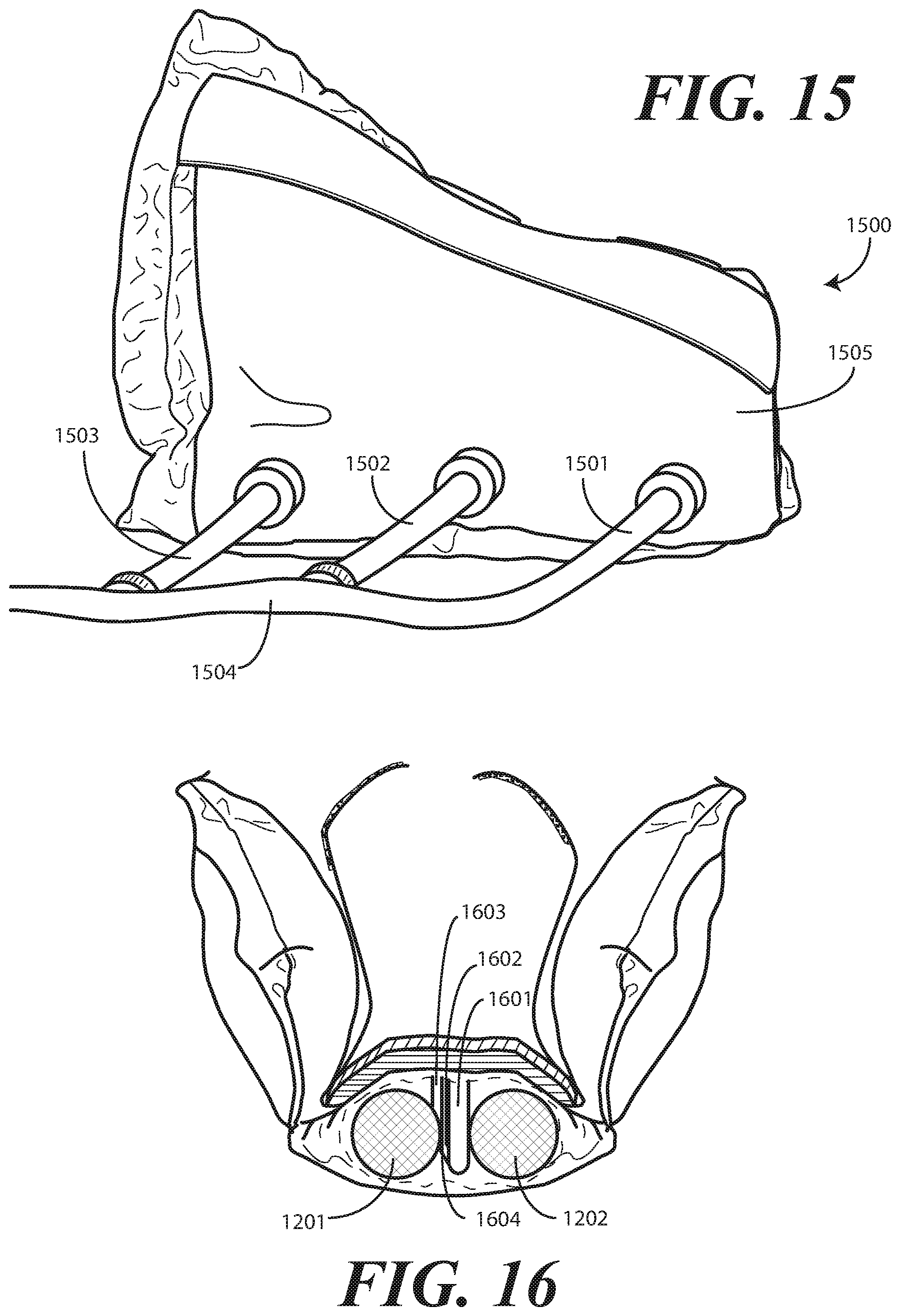 Patent US11771616 Figure 11 – Heel protector and corresponding rehabilitation systems and methods for using the same