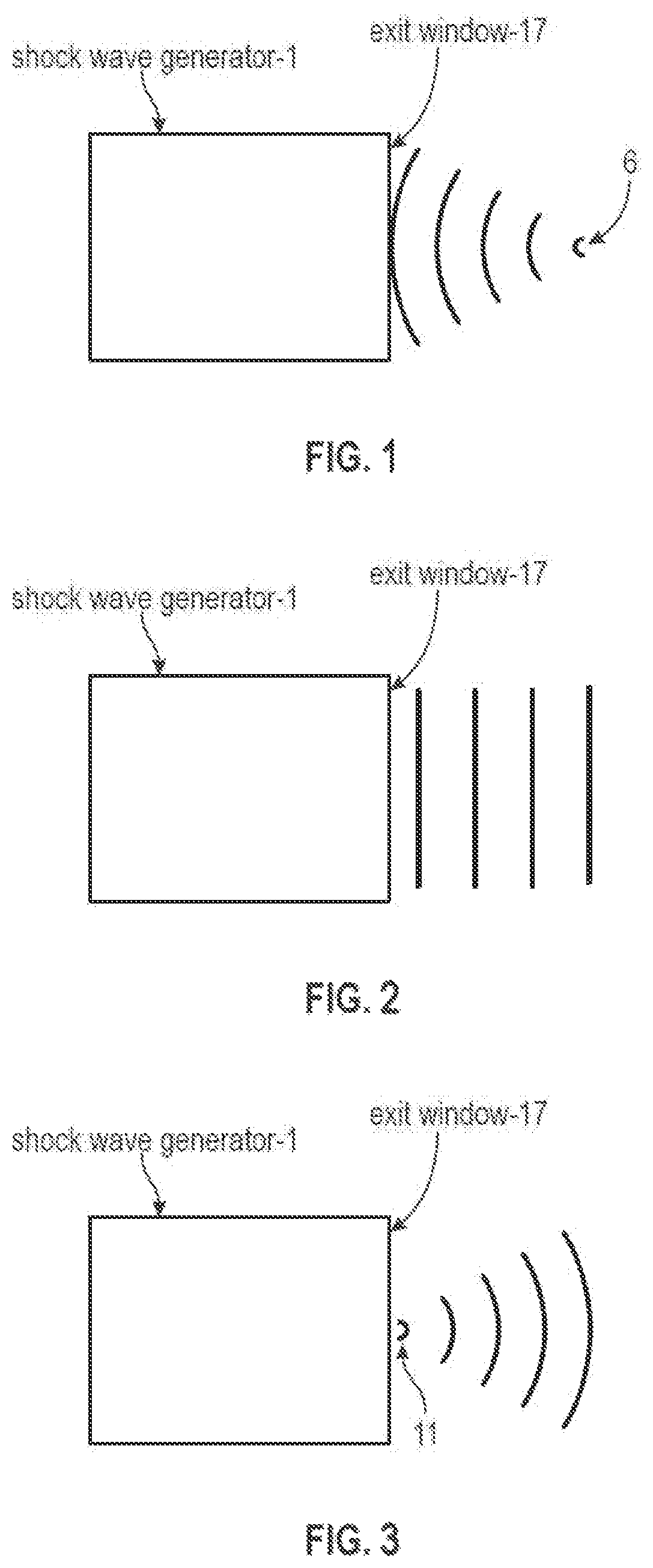 Patent US11771620 — Acoustic shock wave therapeutic methods to prevent or treat opioid addiction — Figure 1