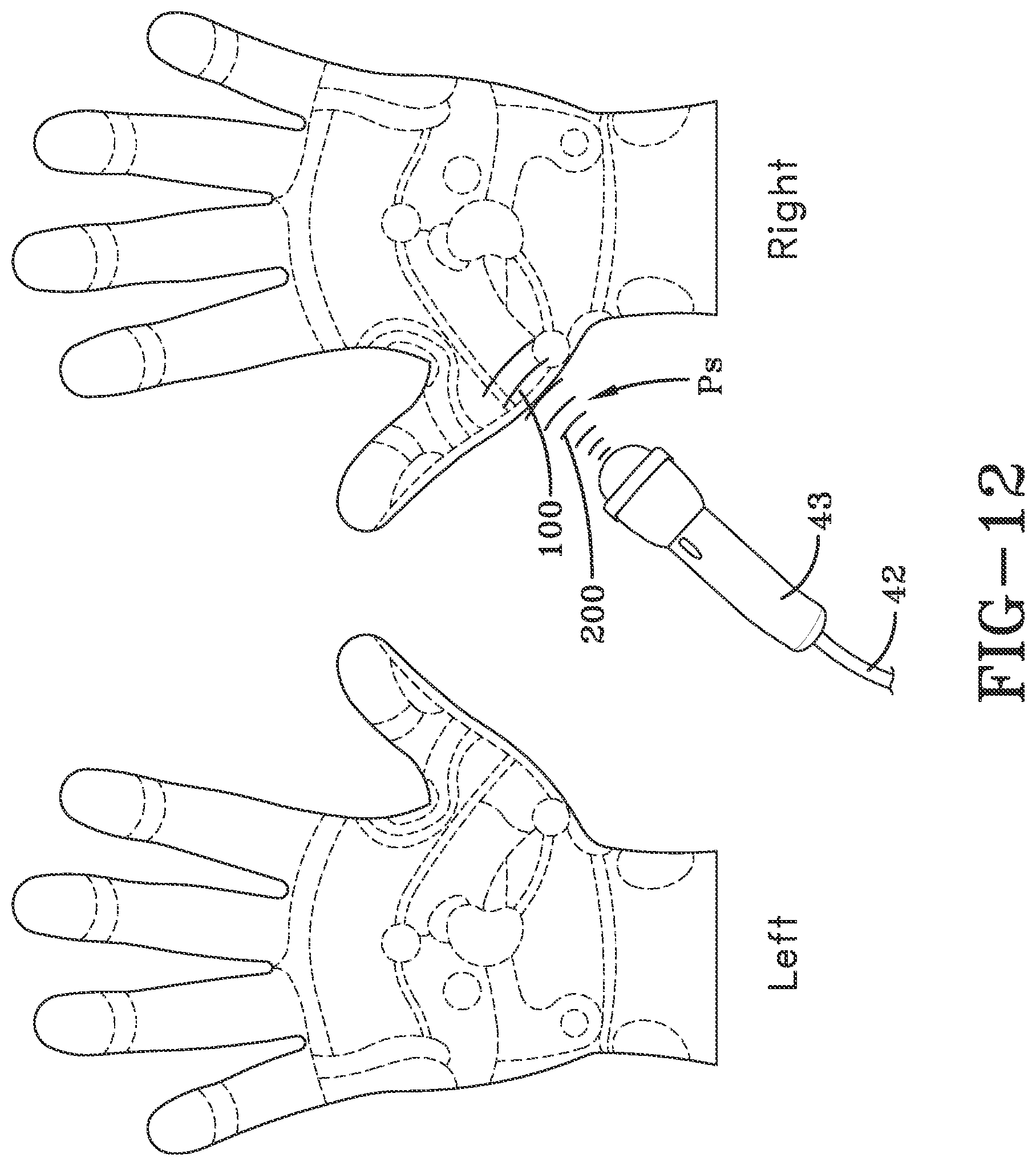 Patent US11771620 Figure 8 – Acoustic shock wave therapeutic methods to prevent or treat opioid addiction