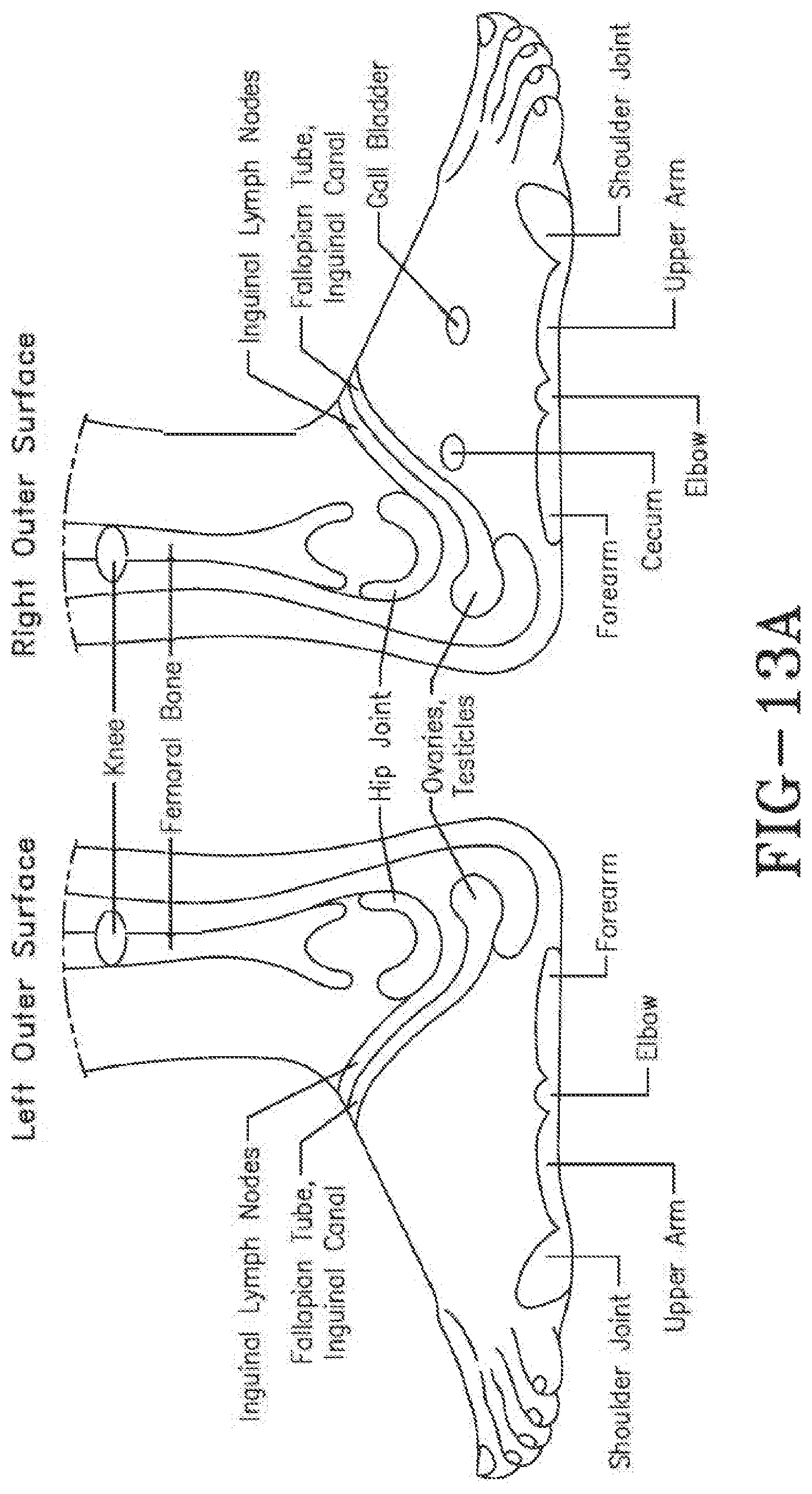 Patent US11771620 Figure 10 – Acoustic shock wave therapeutic methods to prevent or treat opioid addiction