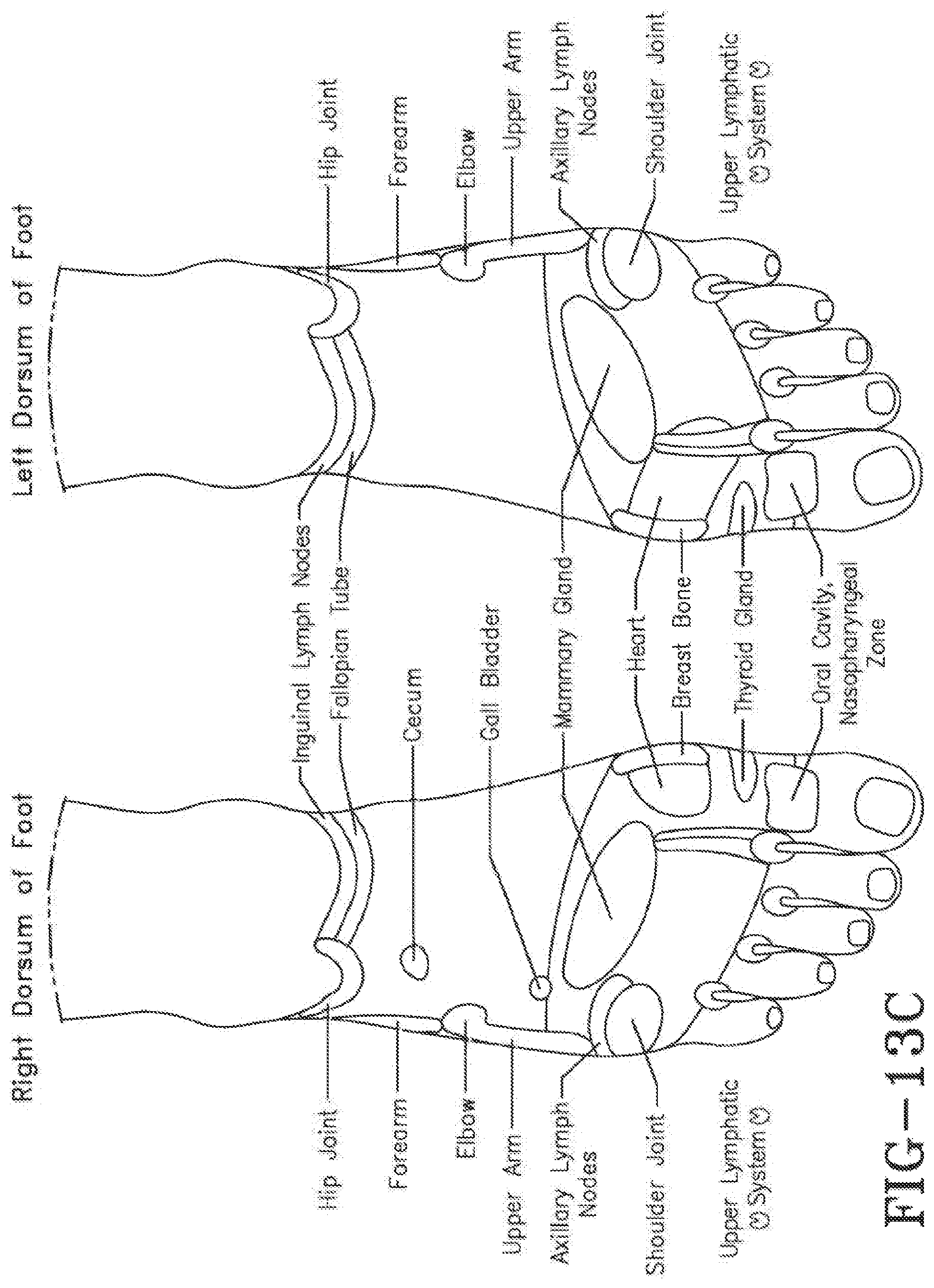 Patent US11771620 Figure 12 – Acoustic shock wave therapeutic methods to prevent or treat opioid addiction