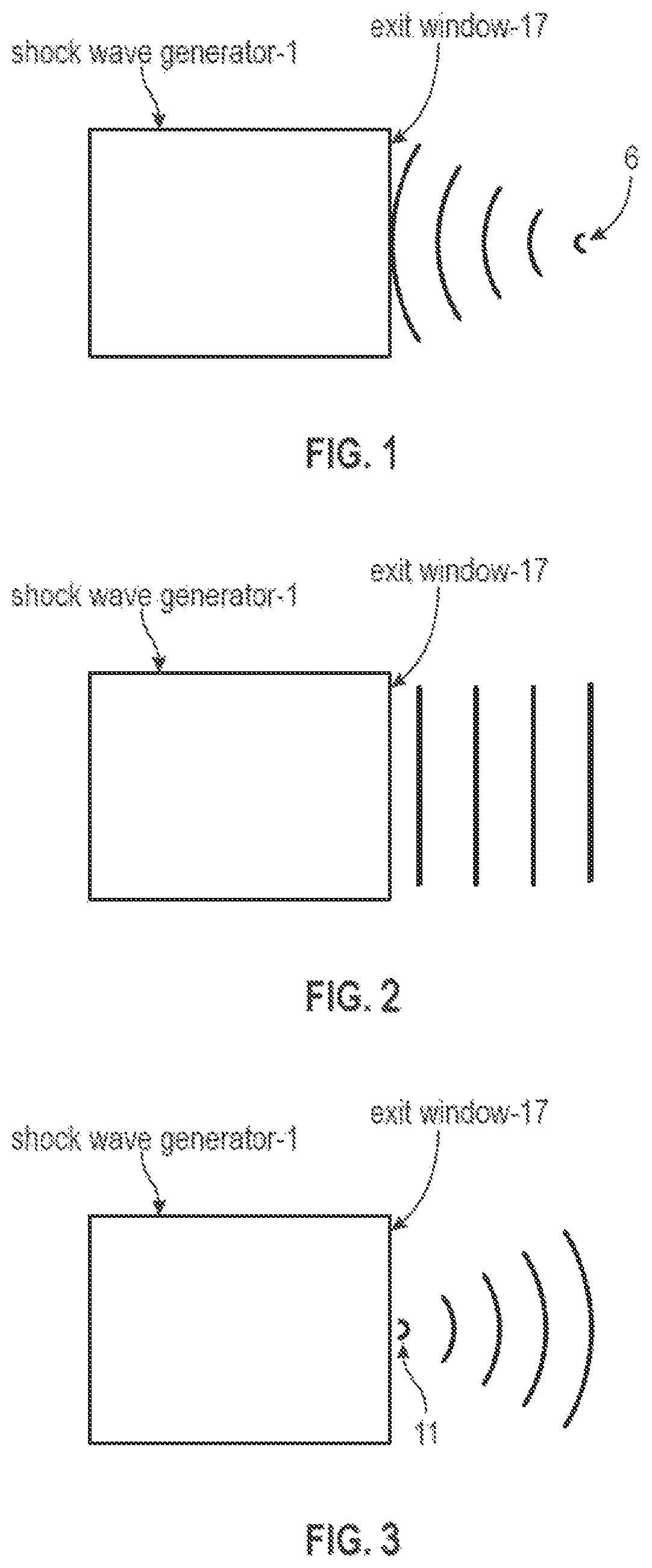 Patent US11771621 Figure 1 – Acoustic shock wave therapeutic methods to prevent or treat opioid addiction