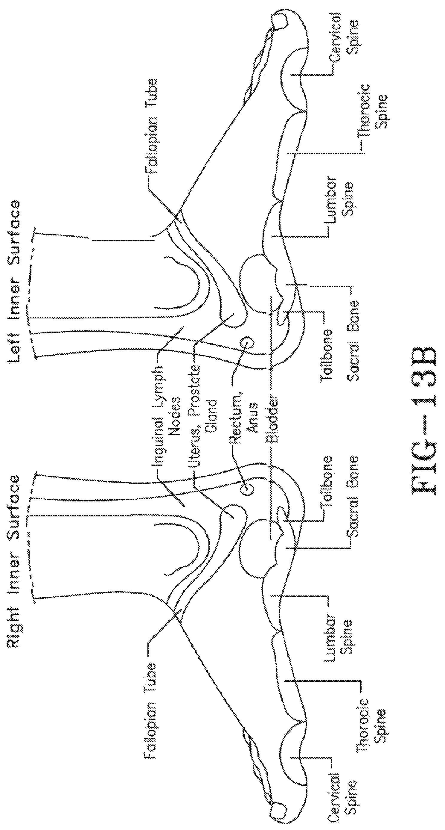 Patent US11771621 Figure 11 – Acoustic shock wave therapeutic methods to prevent or treat opioid addiction