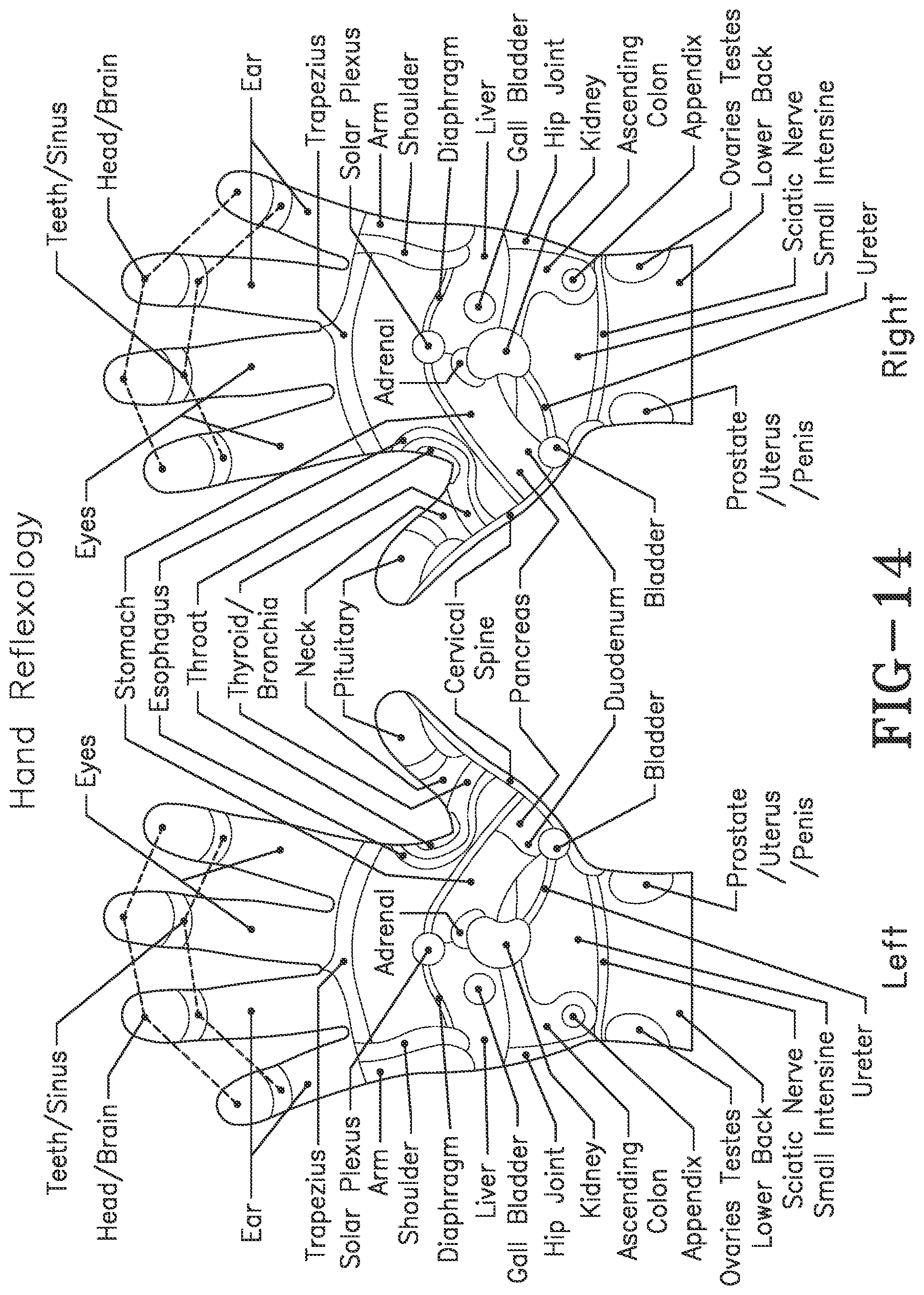 Patent US11771621 Figure 13 – Acoustic shock wave therapeutic methods to prevent or treat opioid addiction