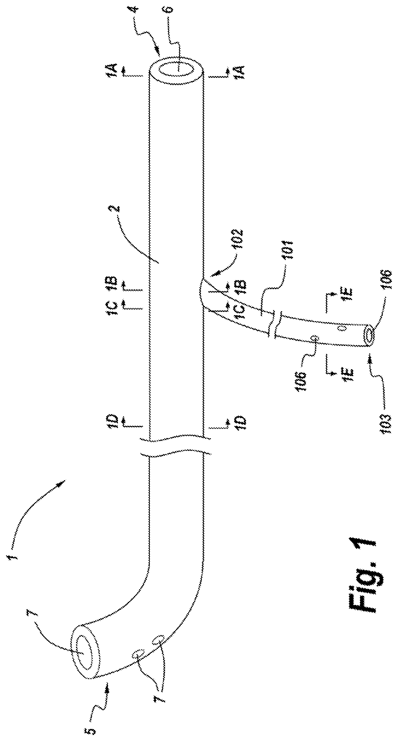 Patent US11771626 Figure 1 – Diverting jejunostomy tube