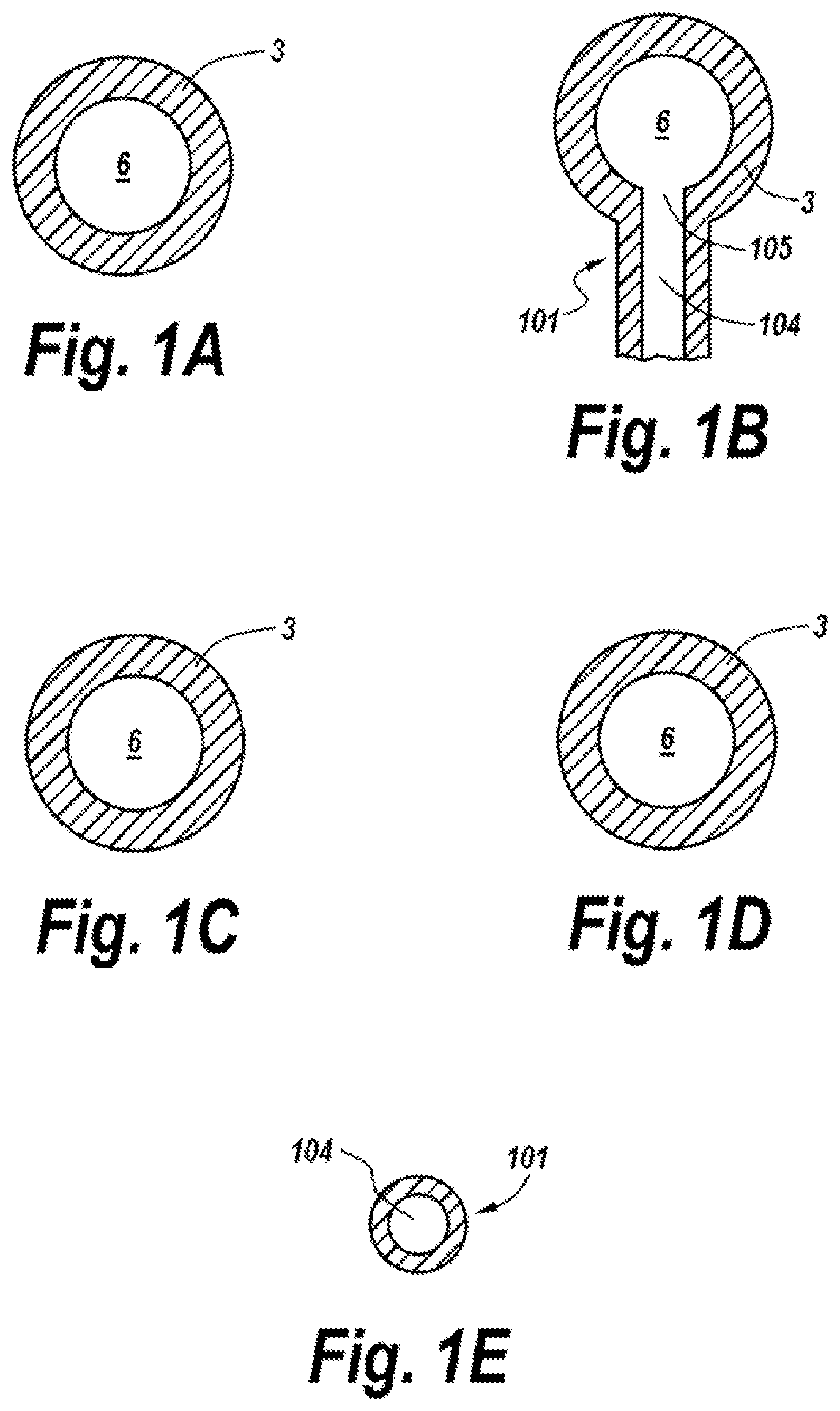 Patent US11771626 Figure 2 – Diverting jejunostomy tube