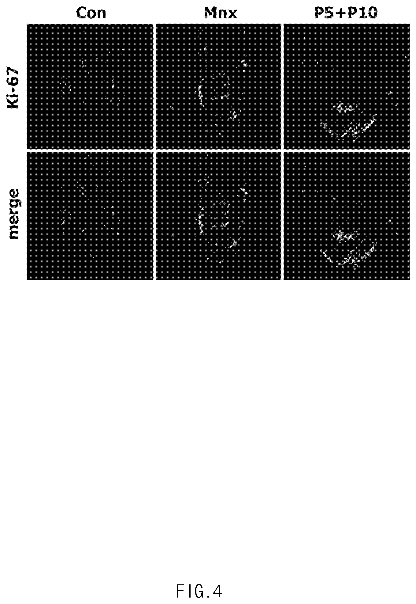 Patent US11771636 Figure 4 – Composition for promoting hair growth comprising adiponectin-derived peptide