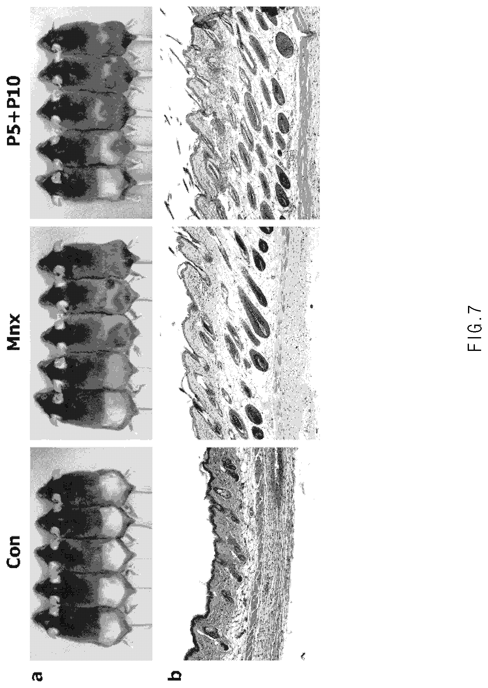 Patent US11771636 Figure 7 – Composition for promoting hair growth comprising adiponectin-derived peptide