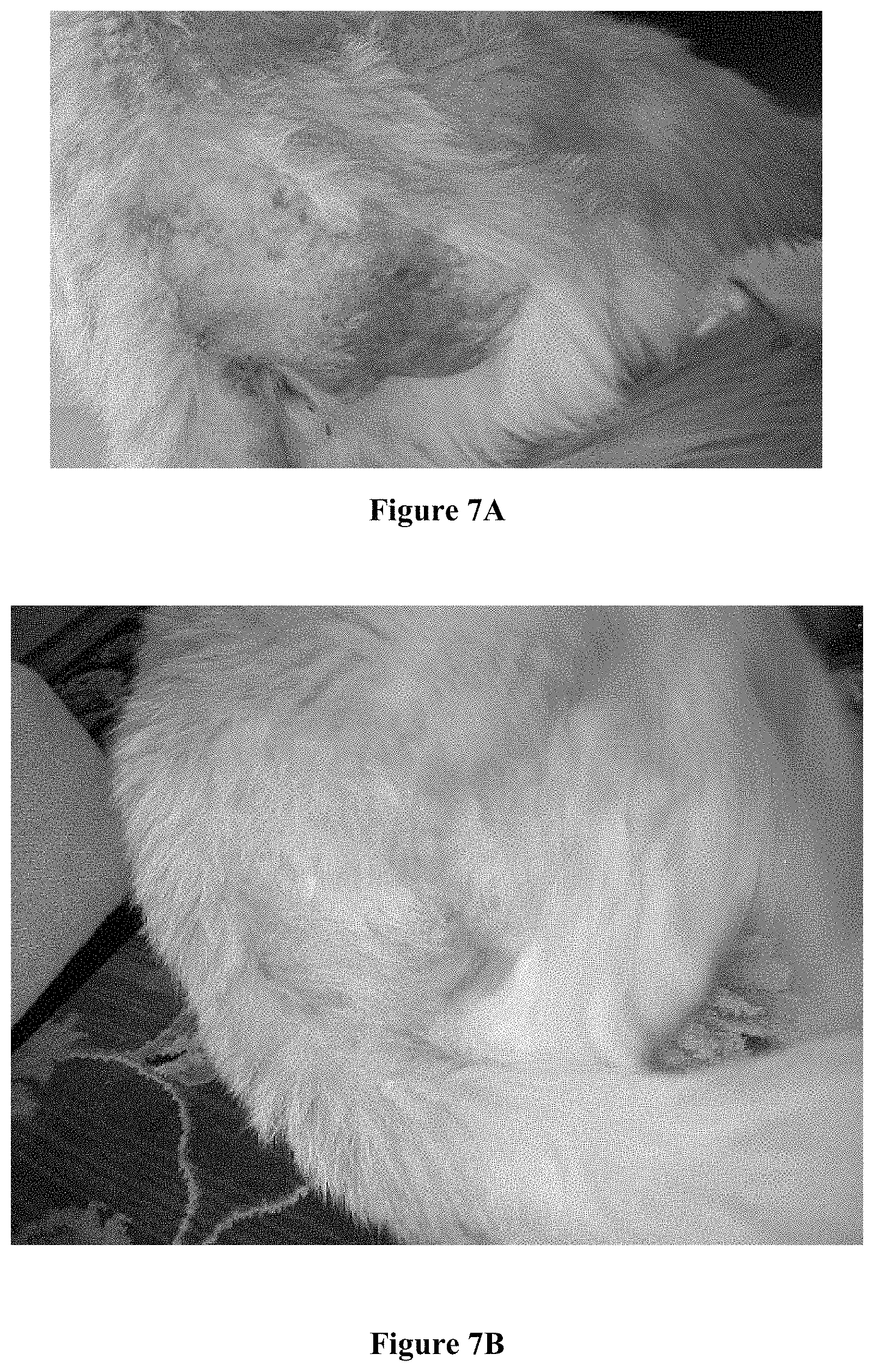 Patent US11771649 Figure 7 – Pharmaceutical lotion or salve utilizing mixed metal hydroxide antimicrobial charged particles