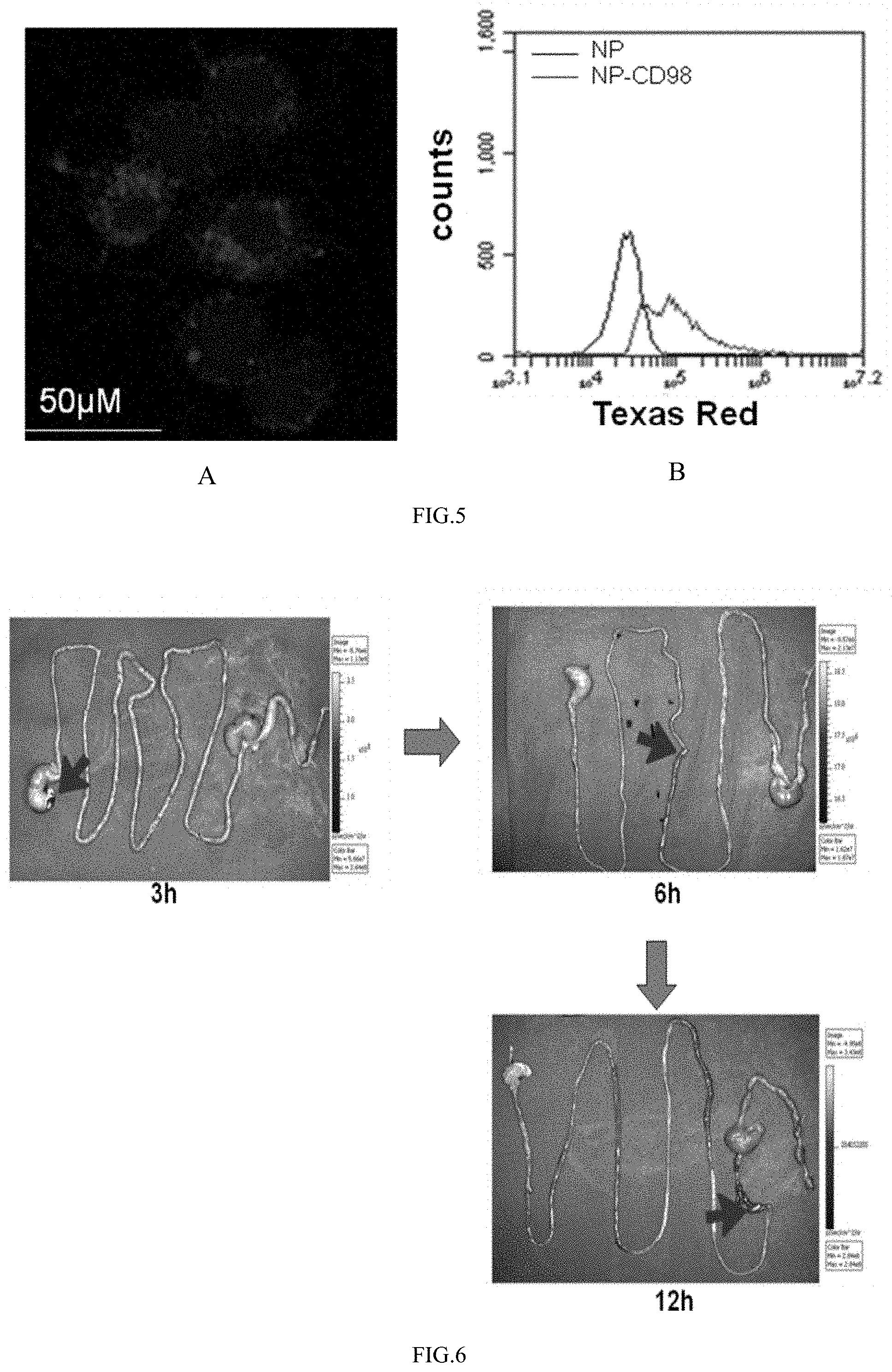 Patent US11771656 Figure 3 – Oral colon-targeted delivery system and preparation method and application thereof