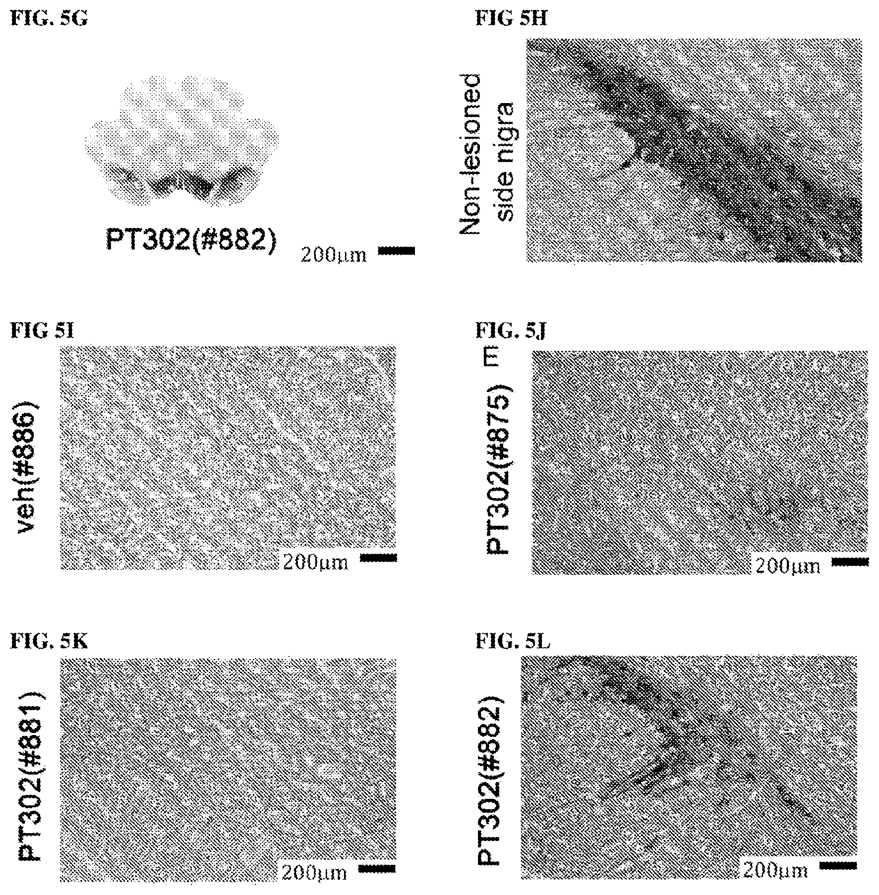 Patent US11771657 Figure 7 – Methods of delivering a neuroprotective polypeptide to the central nervous system