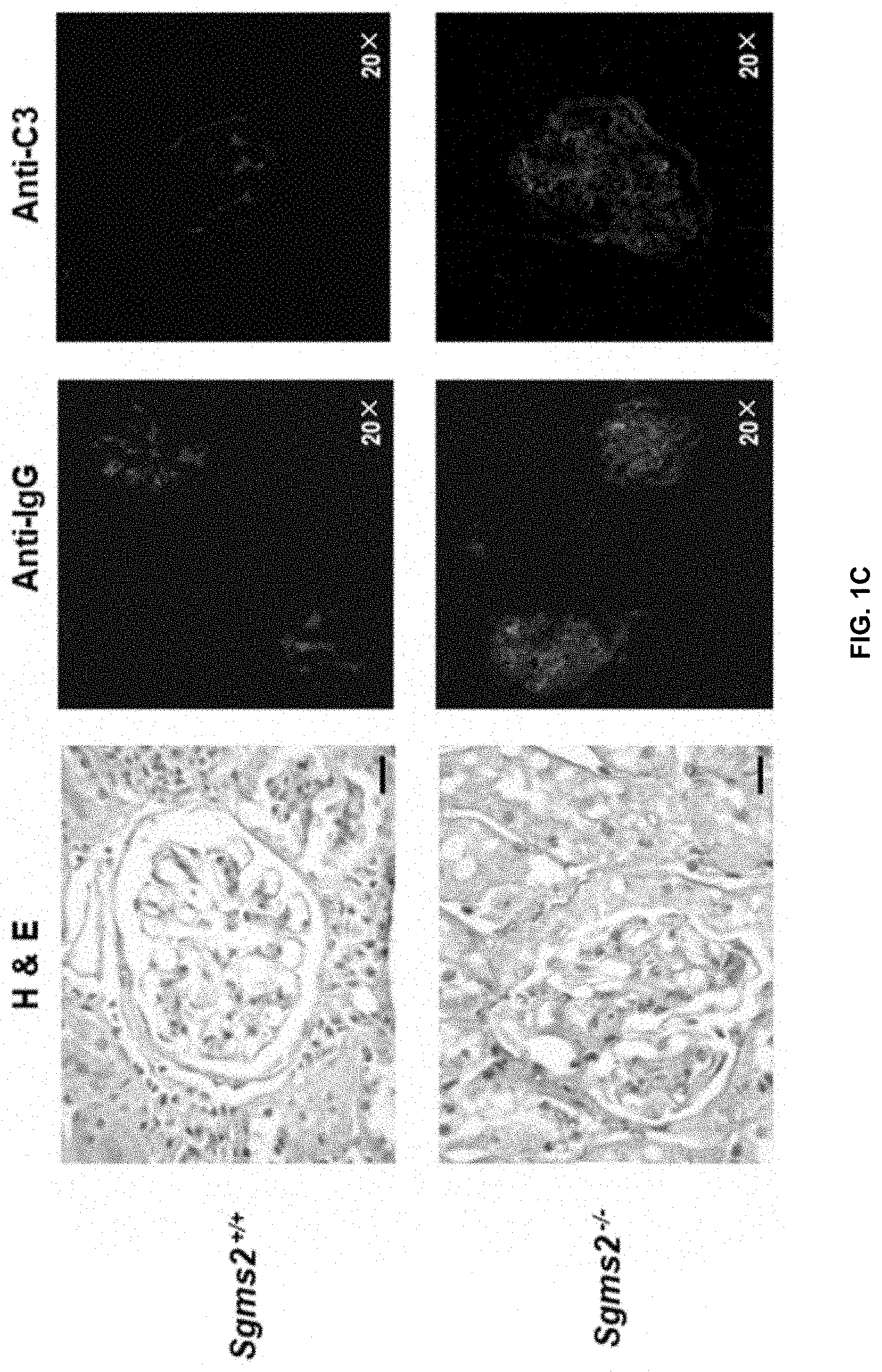 Patent US11771672 Figure 3 – Use of 2-hydroxyoleic acid for the treatment of systemic lupus erythematosus and other immune pathologies