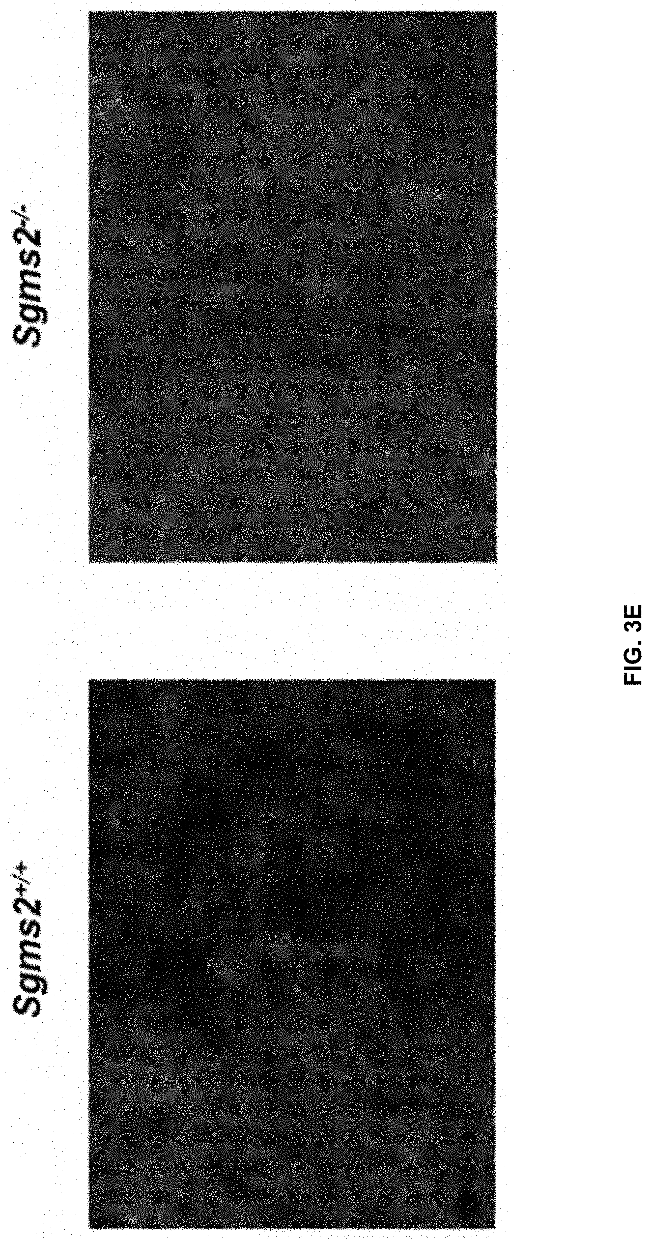 Patent US11771672 Figure 16 – Use of 2-hydroxyoleic acid for the treatment of systemic lupus erythematosus and other immune pathologies