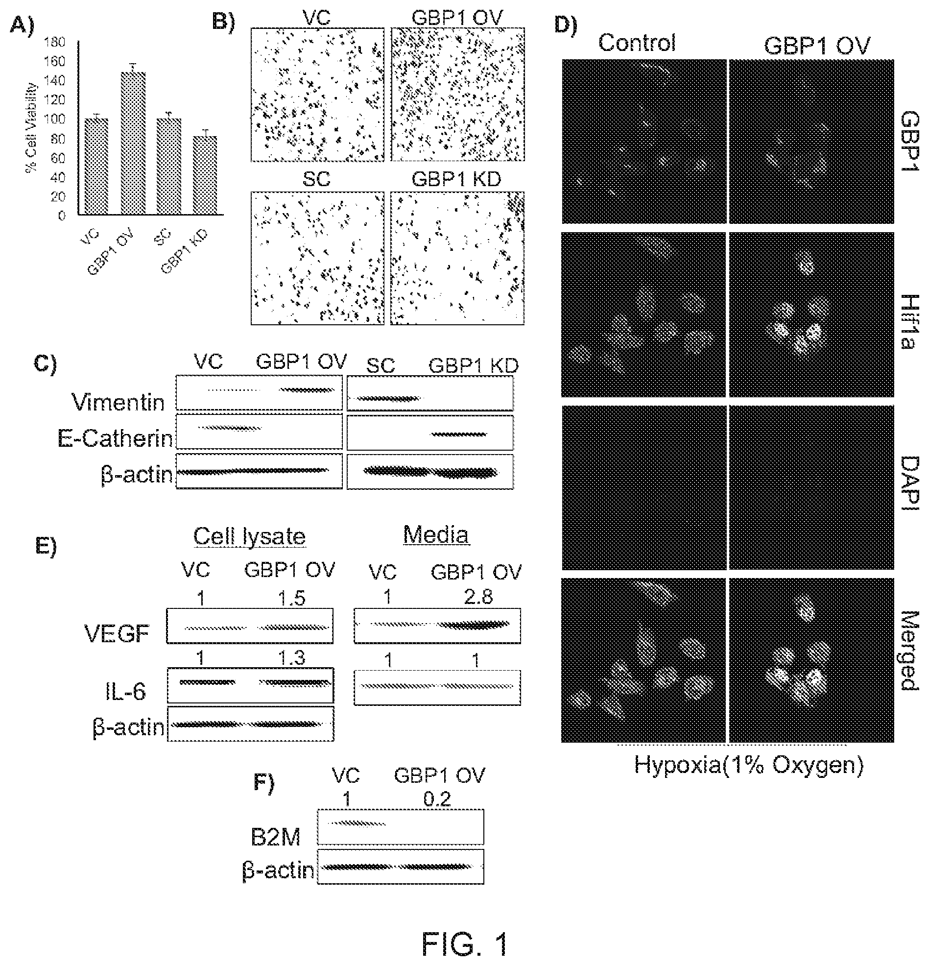 Patent US11771692 Figure 1 – N-hydroxyethyl didehydroazapodophyllotoxins as GBP1 inhibitors and methods of overcoming treatment resistance in cancer
