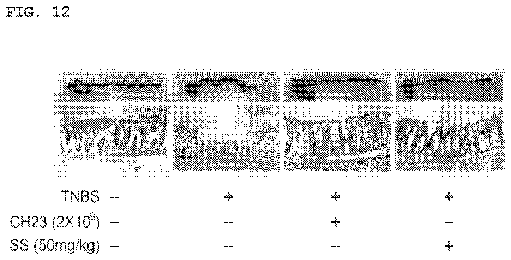 Patent US11771725 Figure 10 – Lactobacillus having various functions, and use thereof