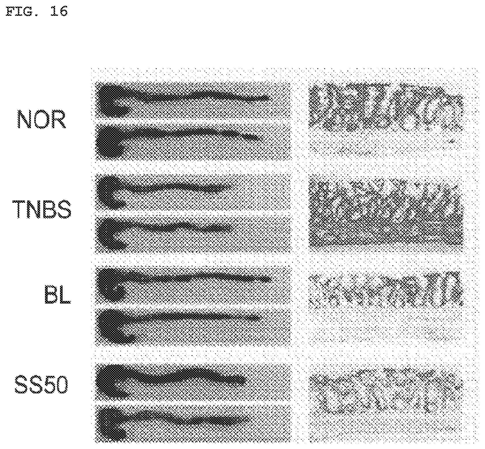 Patent US11771725 Figure 14 – Lactobacillus having various functions, and use thereof