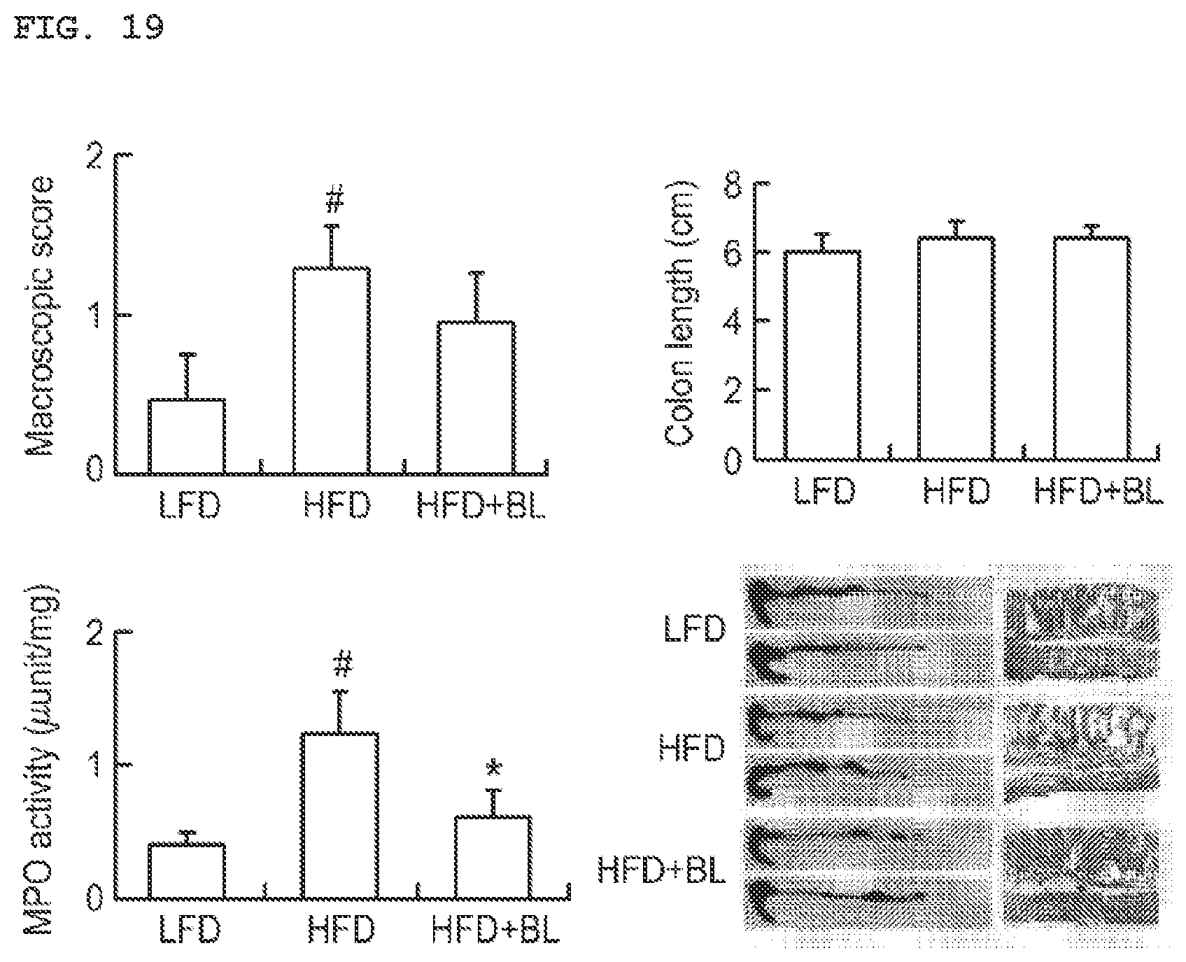 Patent US11771725 Figure 17 – Lactobacillus having various functions, and use thereof