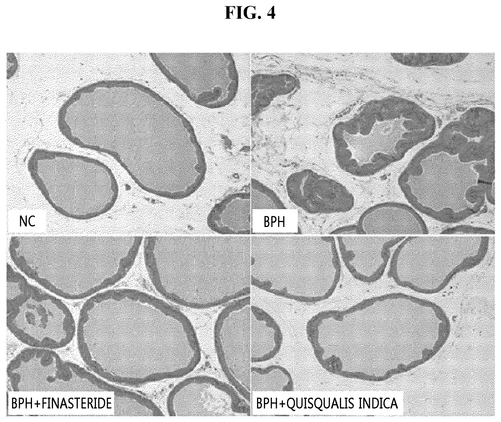 Patent US11771726 Figure 4 – Composition, containing Quisqualis indica extract, for preventing or treating prostatic hyperplasia