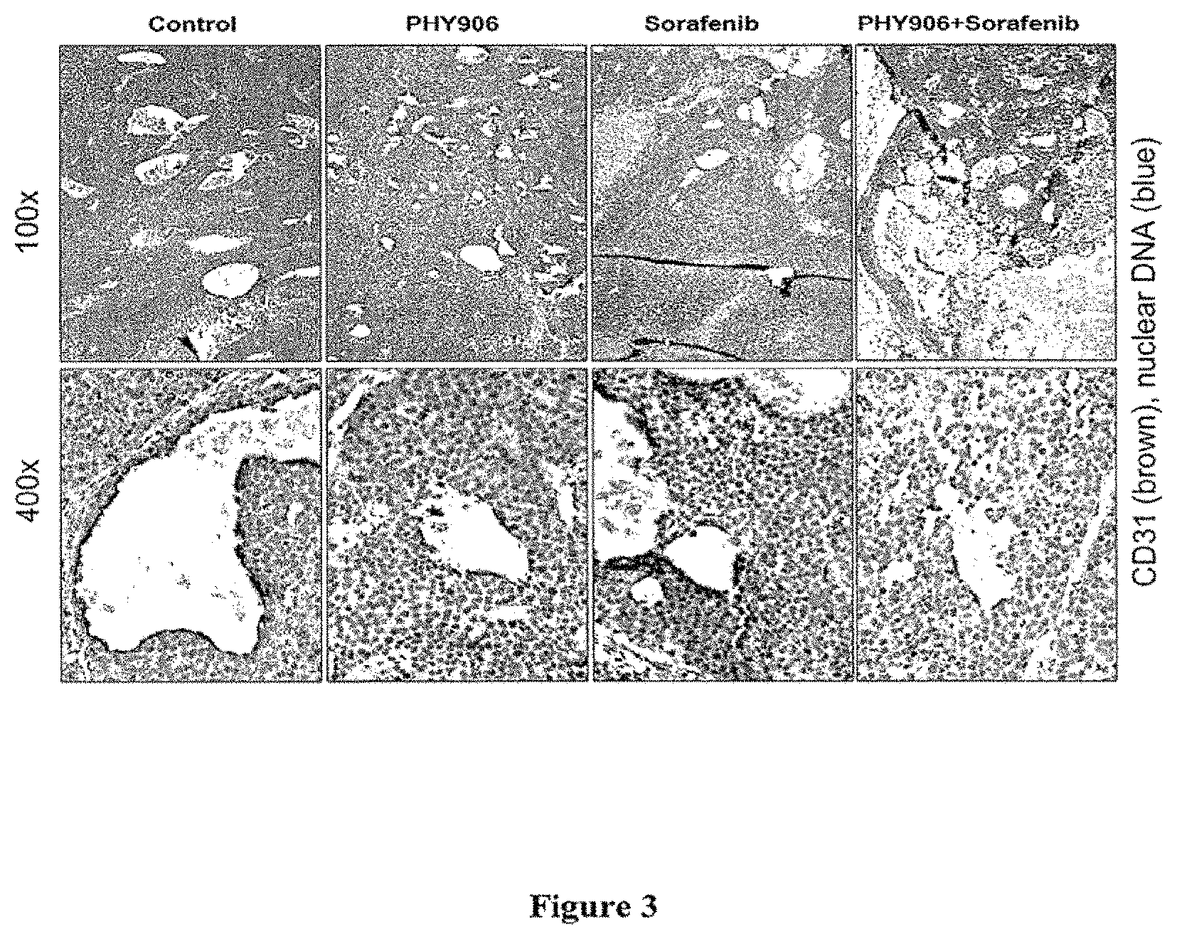 Patent US11771731 Figure 3 – Herbal composition PHY906 and its use in chemotherapy