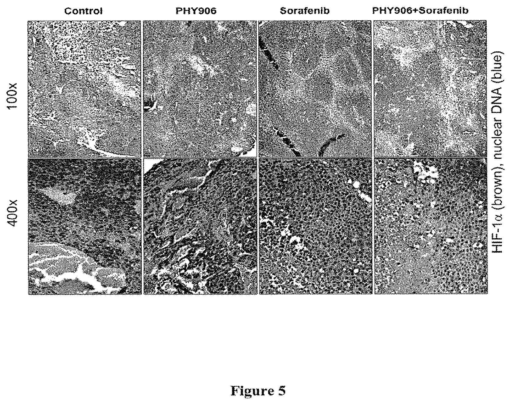 Patent US11771731 Figure 5 – Herbal composition PHY906 and its use in chemotherapy