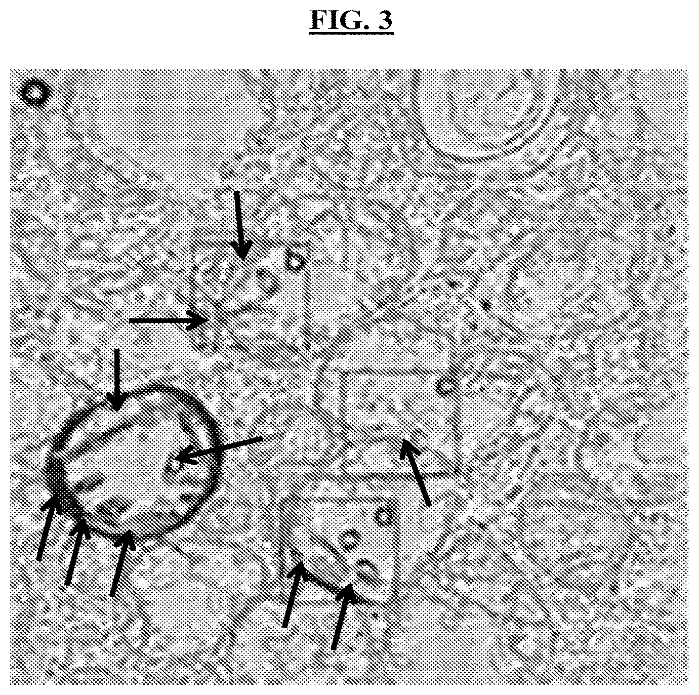 Patent US11771734 Figure 3 – Methods and compositions for the prevention or treatment of Barth syndrome