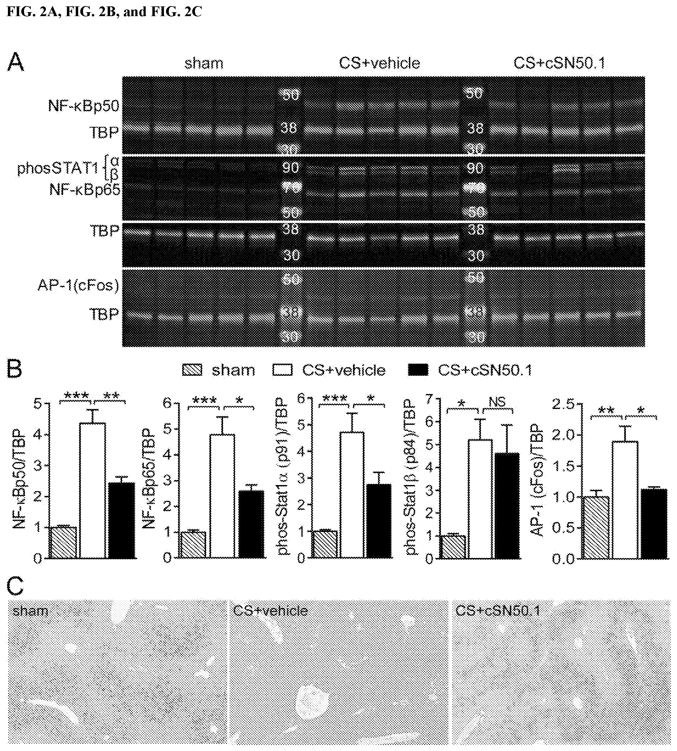 Patent US11771739 Figure 2 – Methods and compositions for treating microbial inflammation