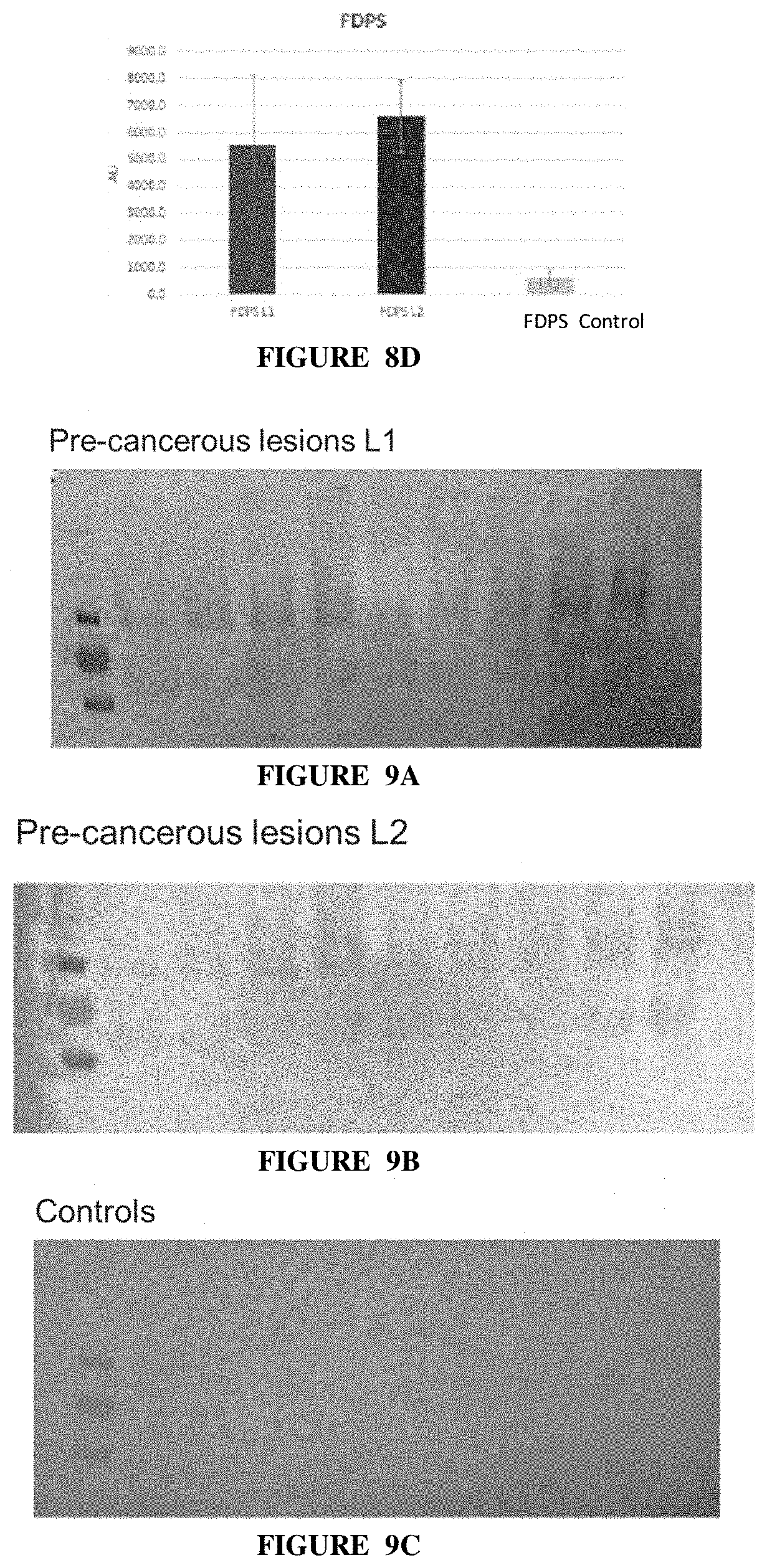 Patent US11771740 Figure 9 – Methods of diagnosing and treating cervical cancer