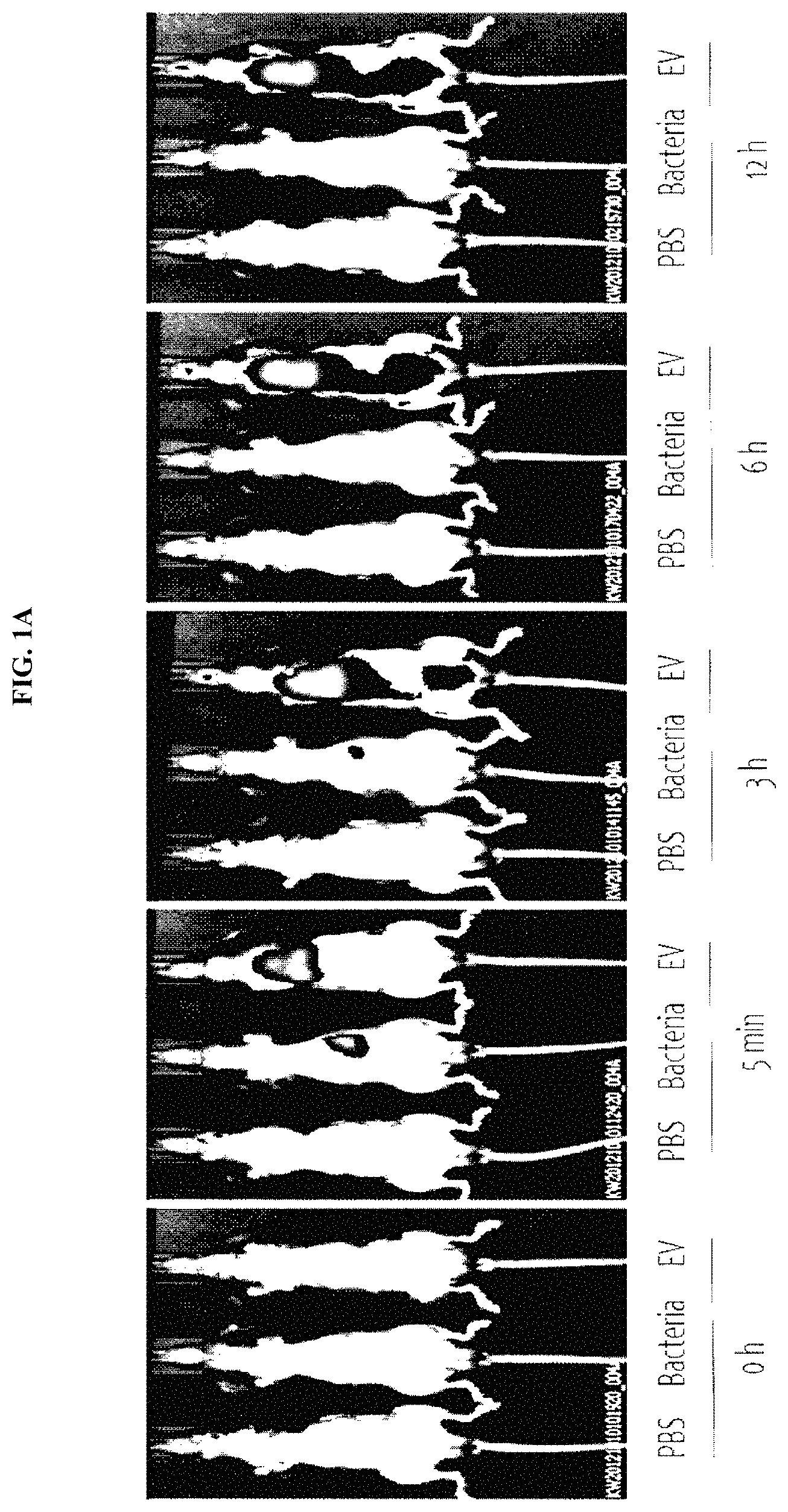 Patent US11771742 Figure 1 – Nano-vesicles derived from genus cupriavidus bacteria and use thereof
