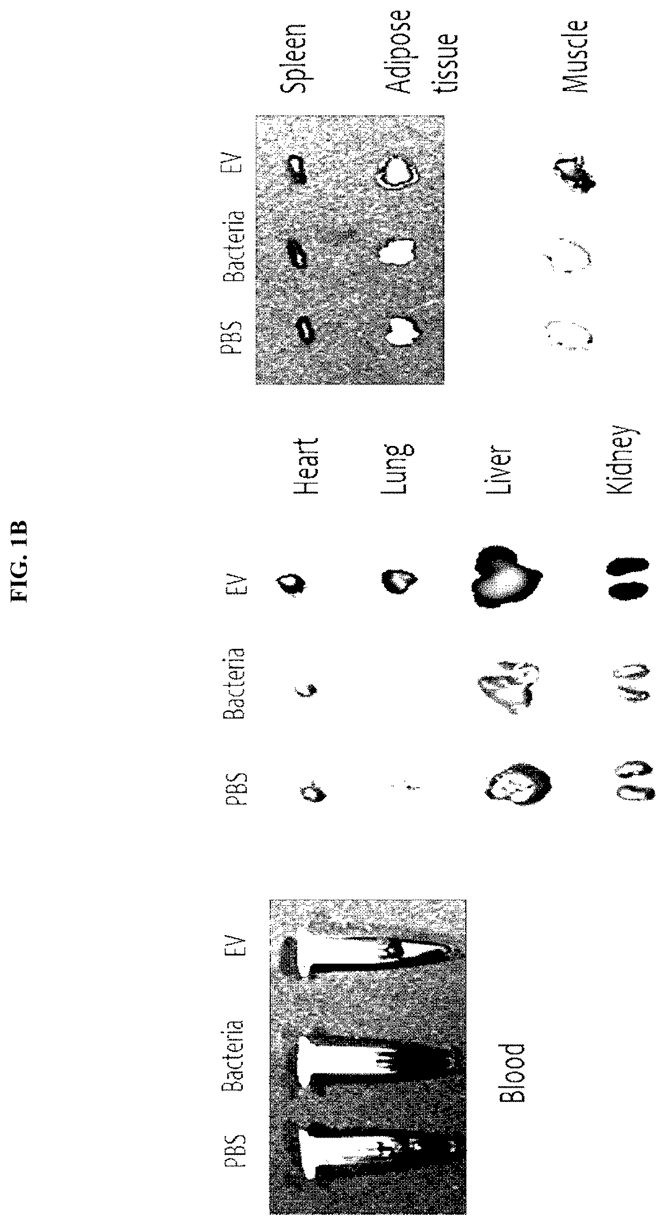 Patent US11771742 Figure 2 – Nano-vesicles derived from genus cupriavidus bacteria and use thereof