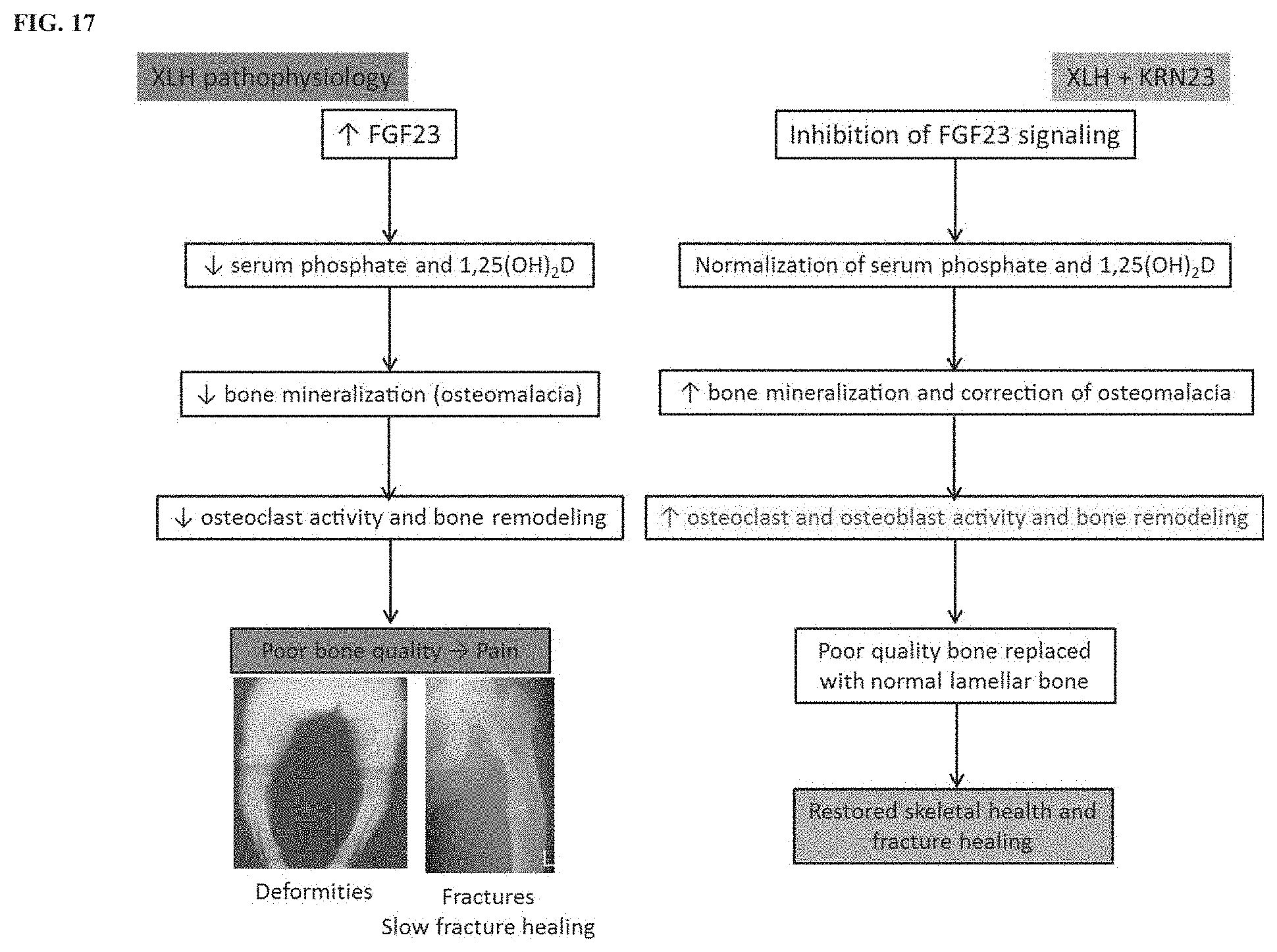 Patent US11771748 Figure 17 – Methods for treating tumor-induced osteomalacia