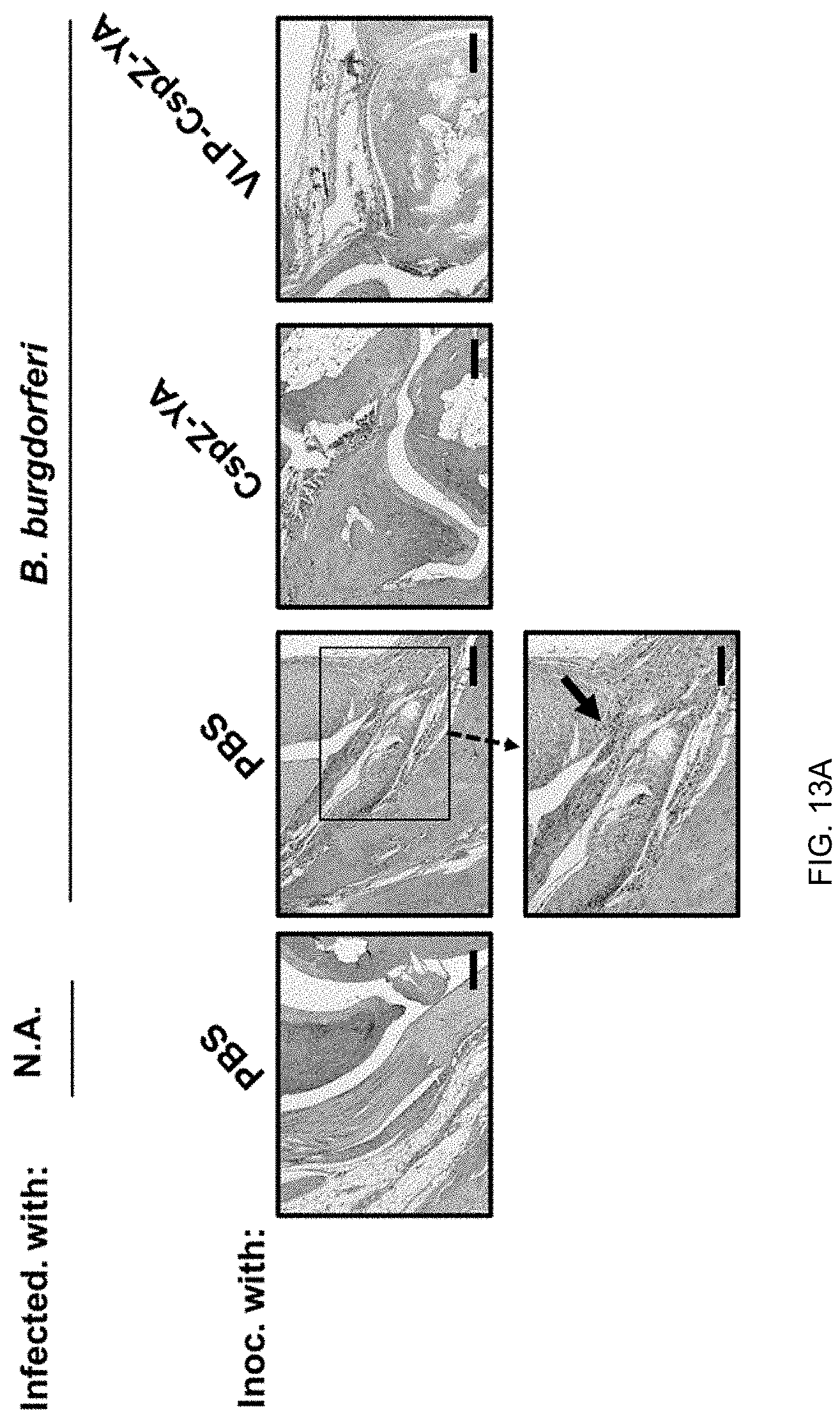 Patent US11771750 Figure 11 – Composition and method for generating immunity to Borrelia burgdorferi