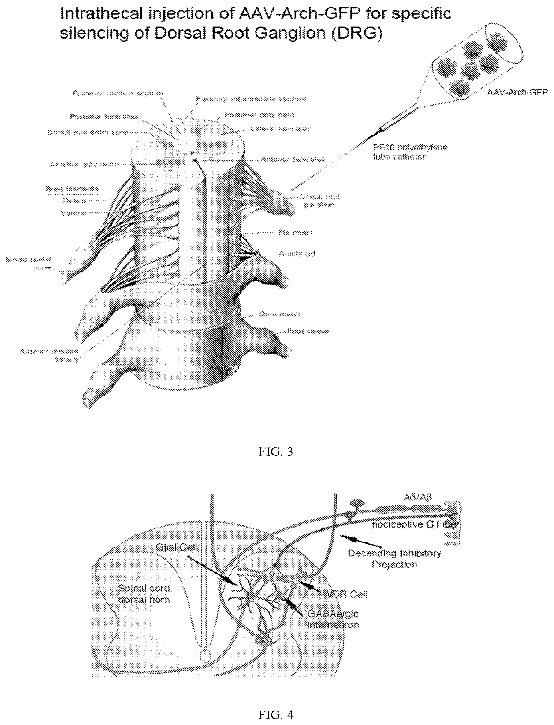 Patent US11771763 Figure 2 – Methods and compositions for decreasing chronic pain