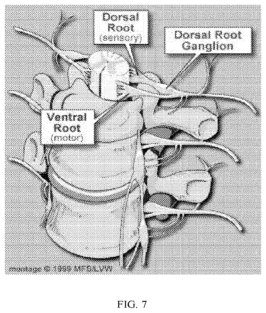 Patent US11771763 Figure 4 – Methods and compositions for decreasing chronic pain