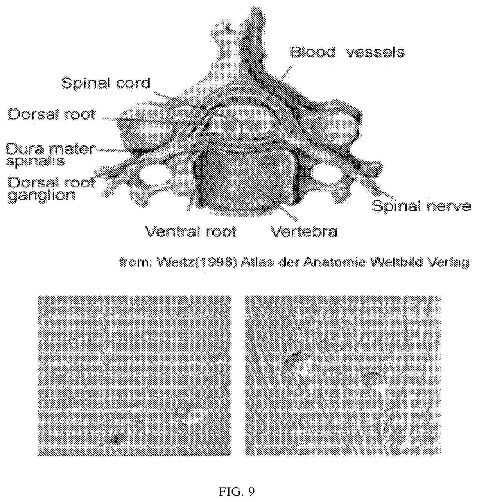 Patent US11771763 Figure 6 – Methods and compositions for decreasing chronic pain