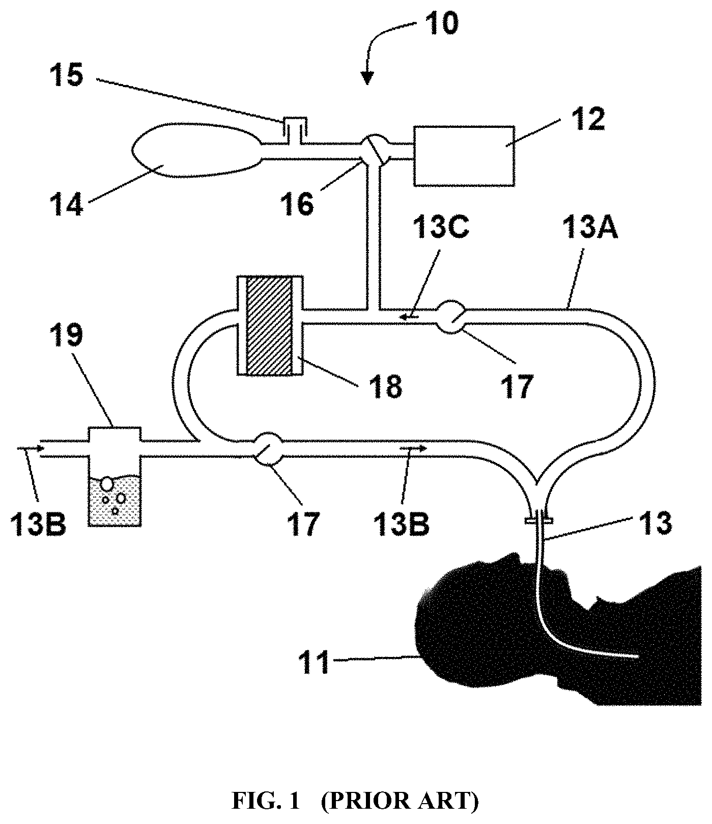 Patent US11771781 Figure 1 – Reprocessing of contaminated reusable devices with direct contact of pressure waves