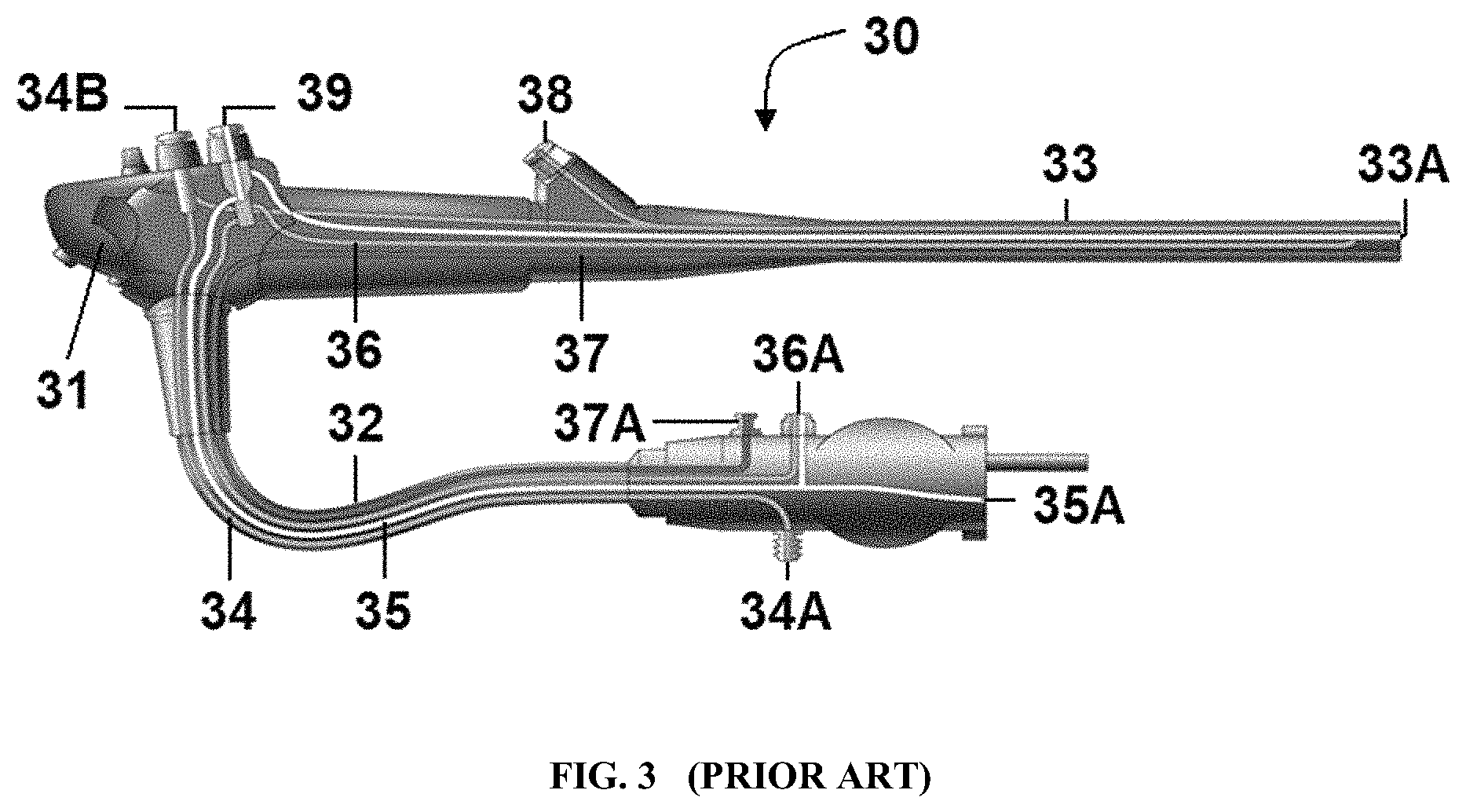 Patent US11771781 Figure 3 – Reprocessing of contaminated reusable devices with direct contact of pressure waves