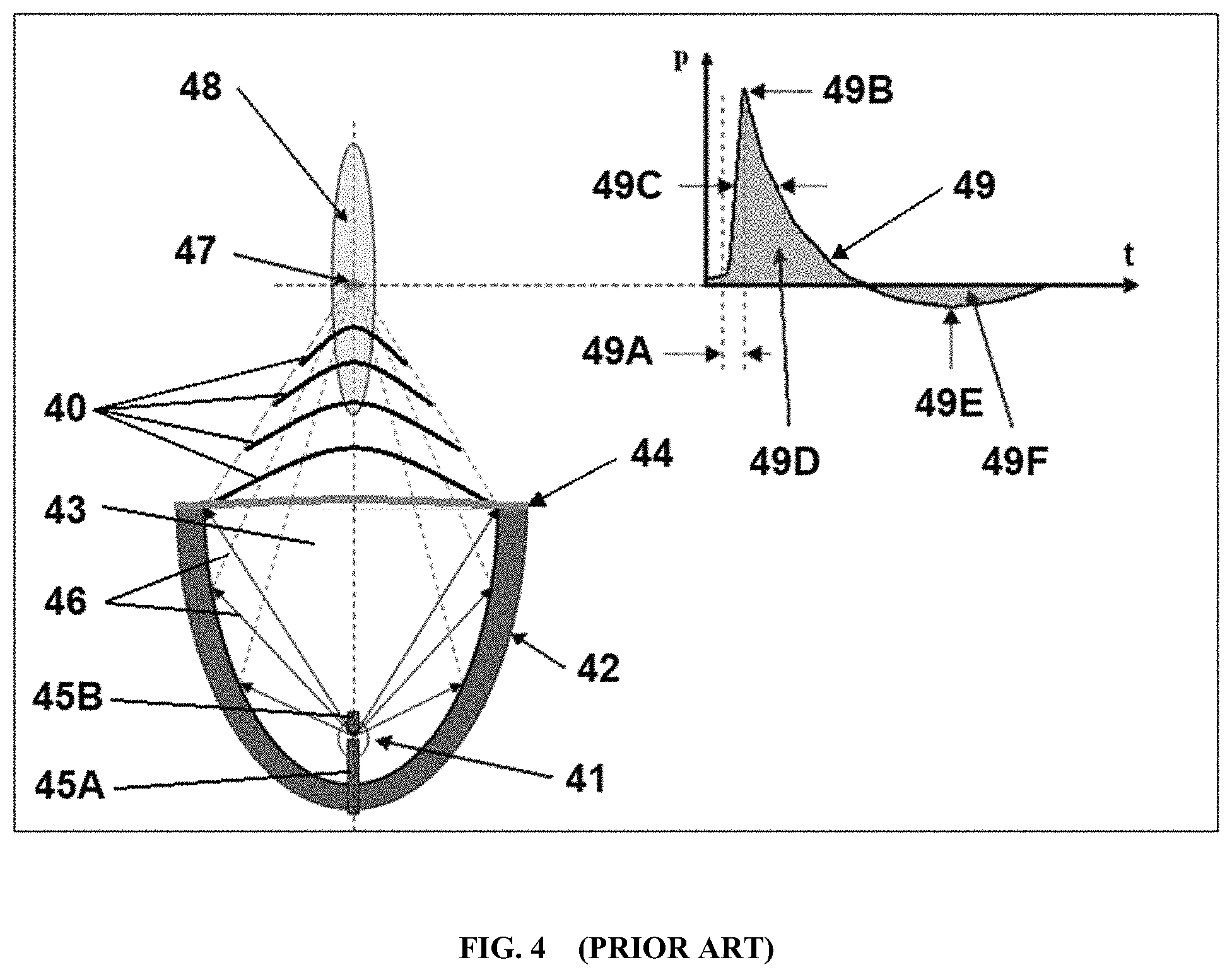 Patent US11771781 Figure 4 – Reprocessing of contaminated reusable devices with direct contact of pressure waves