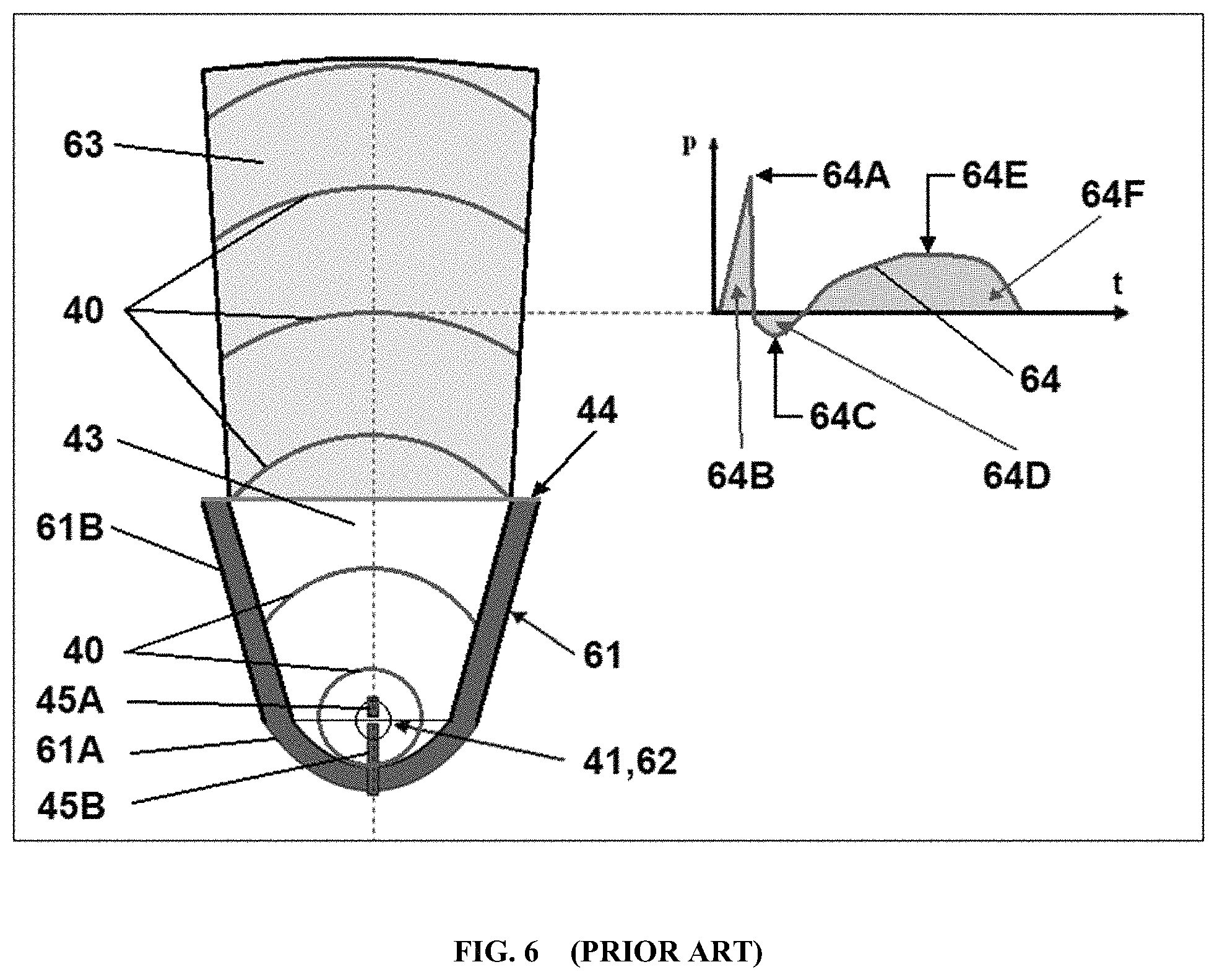 Patent US11771781 Figure 6 – Reprocessing of contaminated reusable devices with direct contact of pressure waves