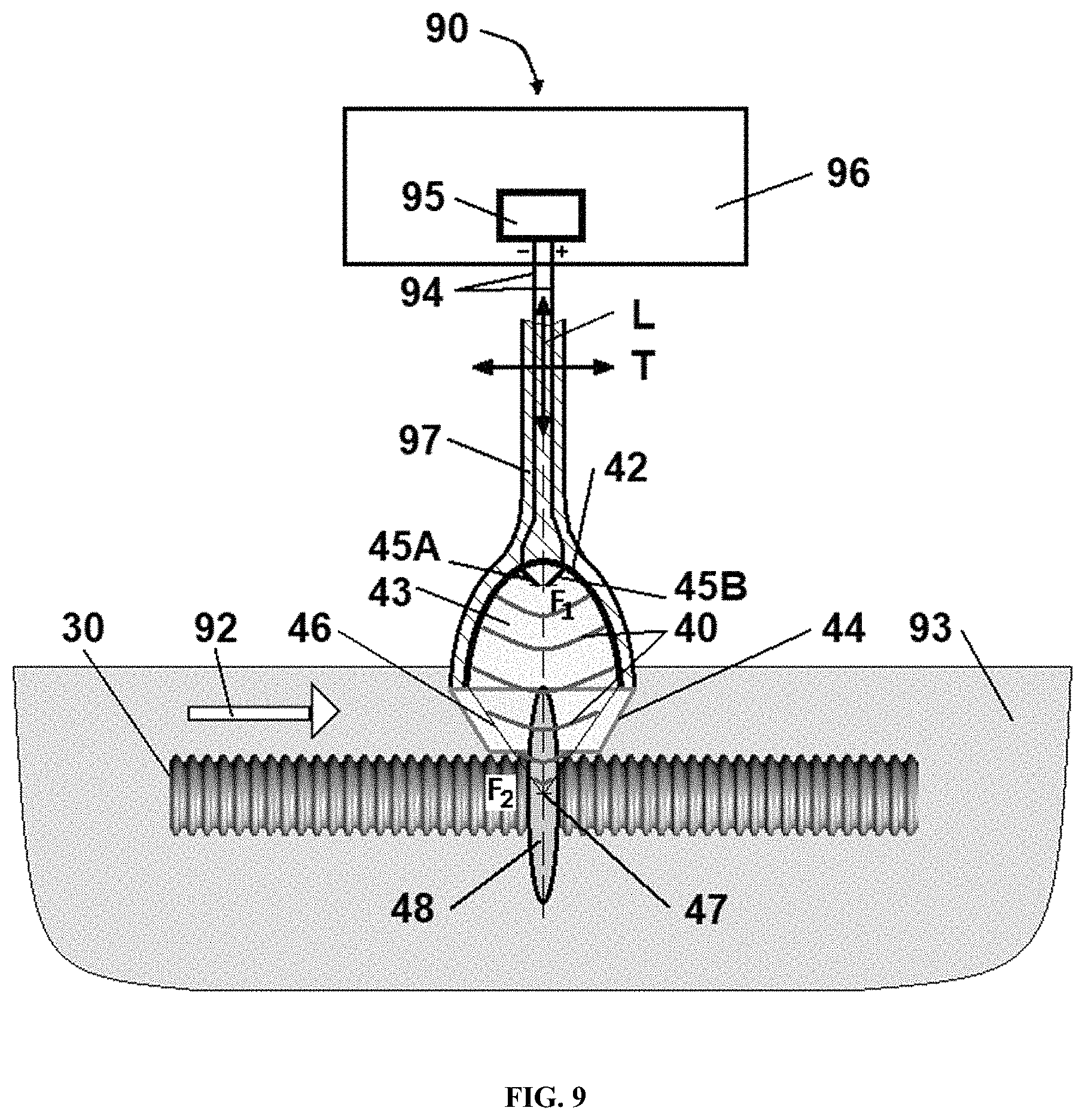 Patent US11771781 Figure 9 – Reprocessing of contaminated reusable devices with direct contact of pressure waves