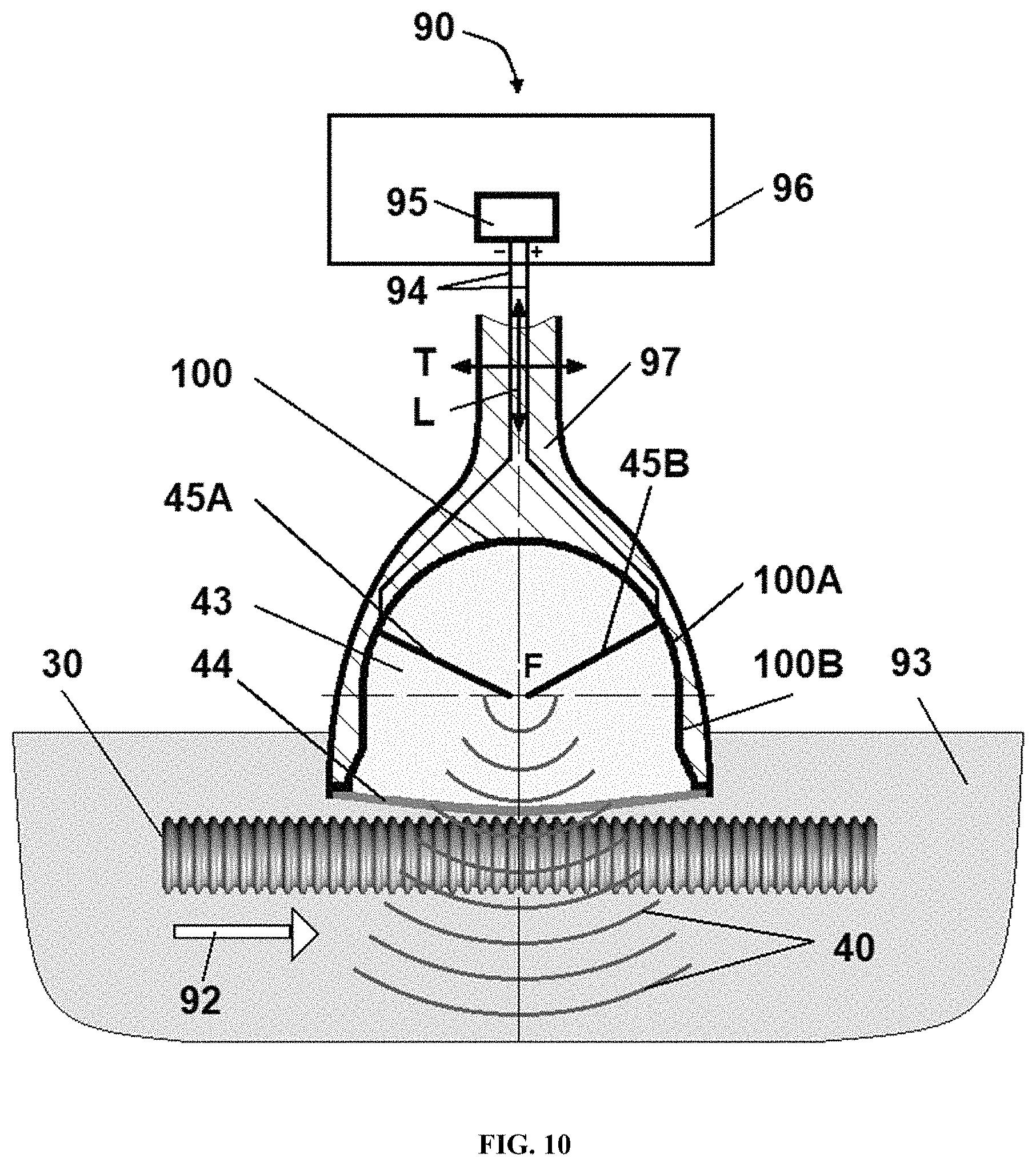 Patent US11771781 Figure 10 – Reprocessing of contaminated reusable devices with direct contact of pressure waves